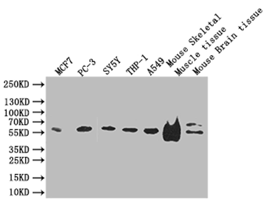 Western blot. All lanes: IFT46 antibody at 8 ug/ml + Mouse skeletal muscle tissue. Secondary. Goat polyclonal to rabbit IgG at 1/10000 dilution. Predicted band size: 35, 41 kDa. Observed band size: 35 kDa. 