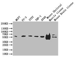 Western blot. All lanes: IFT46 antibody at 8 ug/ml + Mouse skeletal muscle tissue. Secondary. Goat polyclonal to rabbit IgG at 1/10000 dilution. Predicted band size: 35, 41 kDa. Observed band size: 35 kDa. 