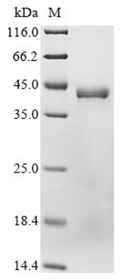 (Tris-Glycine gel) Discontinuous SDS-PAGE (reduced) with 5% enrichment gel and 15% separation gel.