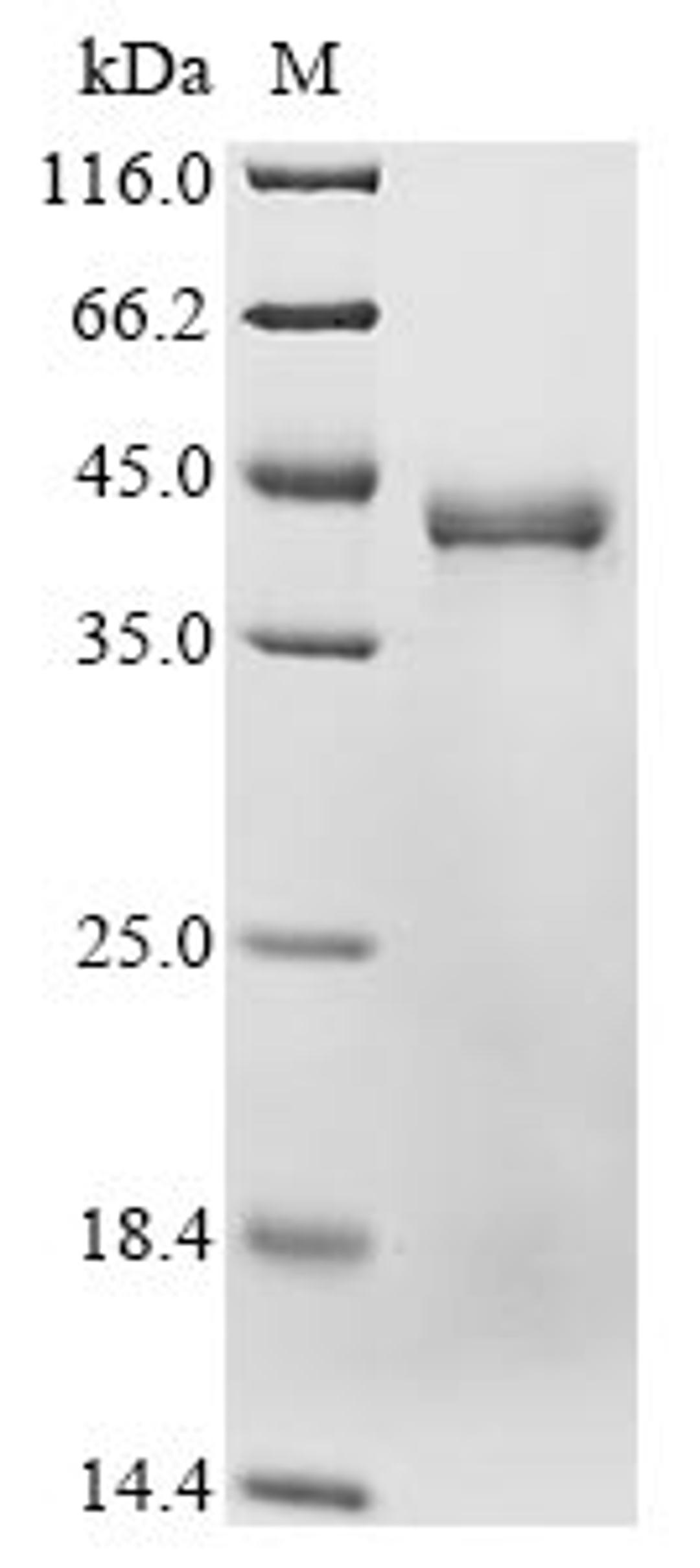 (Tris-Glycine gel) Discontinuous SDS-PAGE (reduced) with 5% enrichment gel and 15% separation gel.
