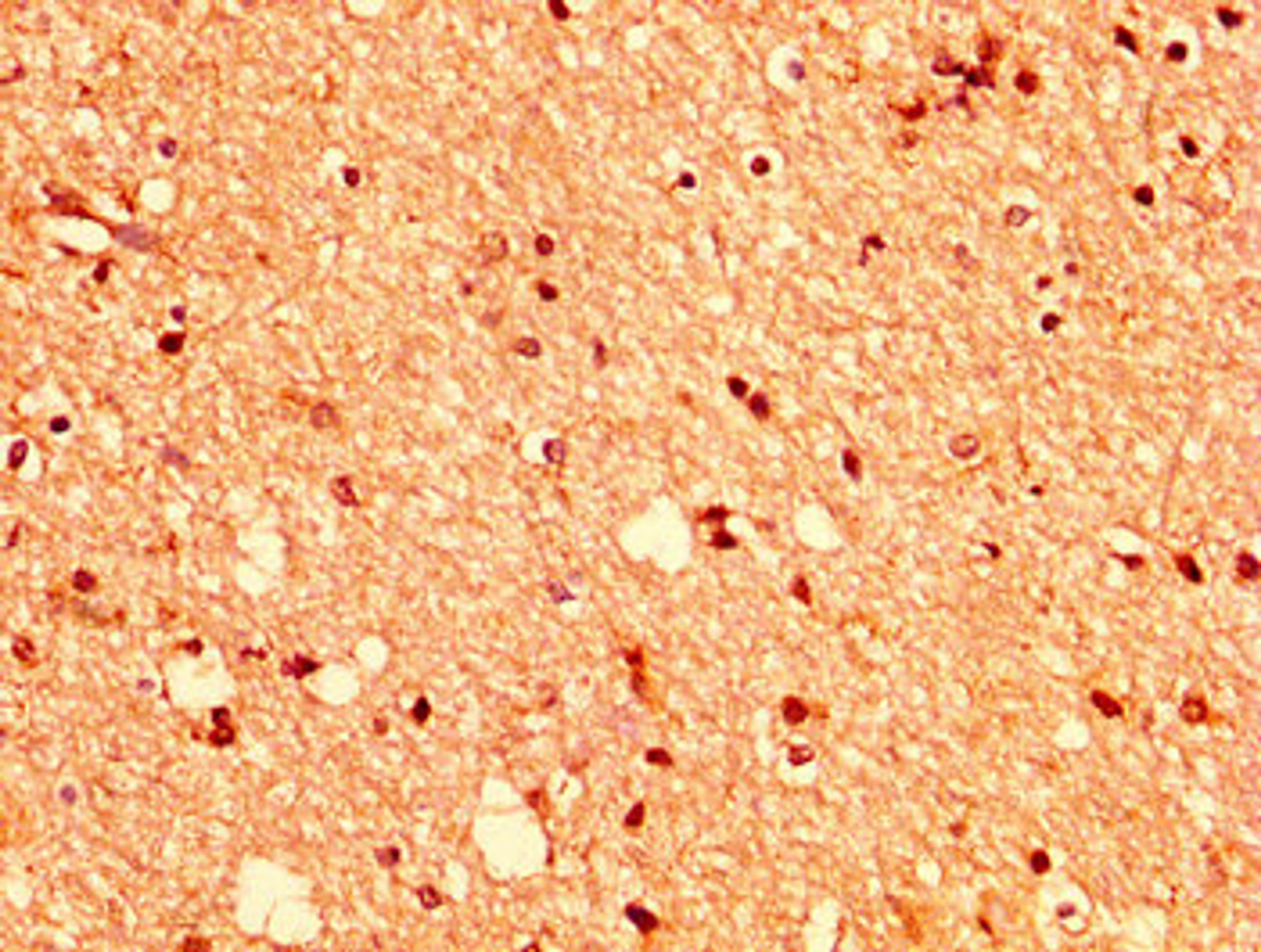 IHC image of CSB-PA007722LA01HU diluted at 1:400 and staining in paraffin-embedded human brain tissue performed on a Leica BondTM system. After dewaxing and hydration, antigen retrieval was mediated by high pressure in a citrate buffer (pH 6.0). Section was blocked with 10% normal goat serum 30min at RT. Then primary antibody (1% BSA) was incubated at 4&deg;C overnight. The primary is detected by a biotinylated secondary antibody and visualized using an HRP conjugated SP system.