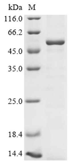 (Tris-Glycine gel) Discontinuous SDS-PAGE (reduced) with 5% enrichment gel and 15% separation gel.