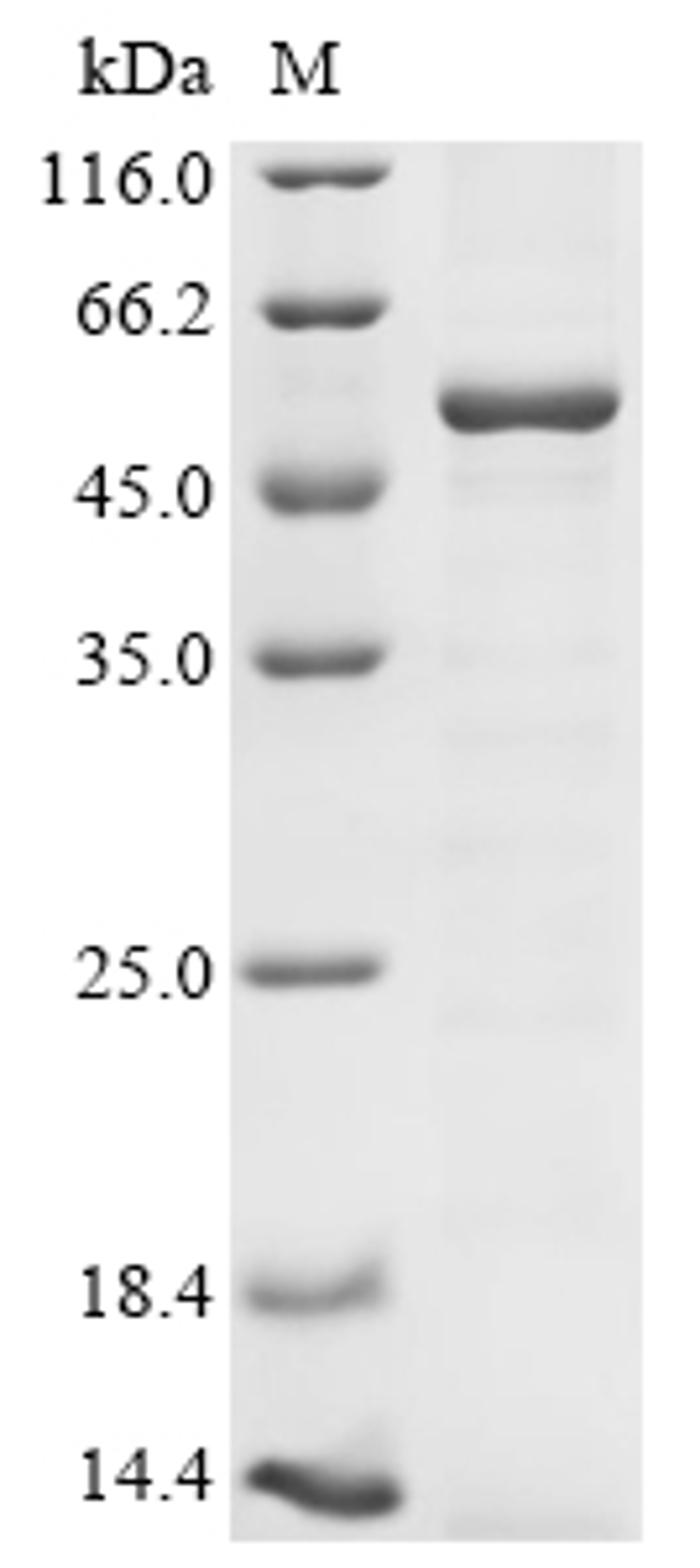 (Tris-Glycine gel) Discontinuous SDS-PAGE (reduced) with 5% enrichment gel and 15% separation gel.