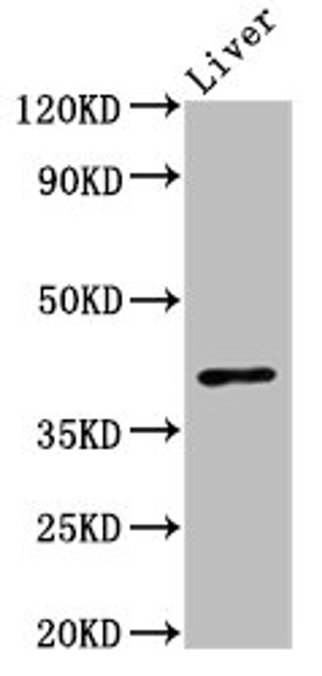 Western Blot. Positive WB detected in: Mouse liver tissue. All lanes: OPRL1 antibody at 3ug/ml. Secondary. Goat polyclonal to rabbit IgG at 1/50000 dilution. Predicted band size: 41 kDa. Observed band size: 41 kDa. 