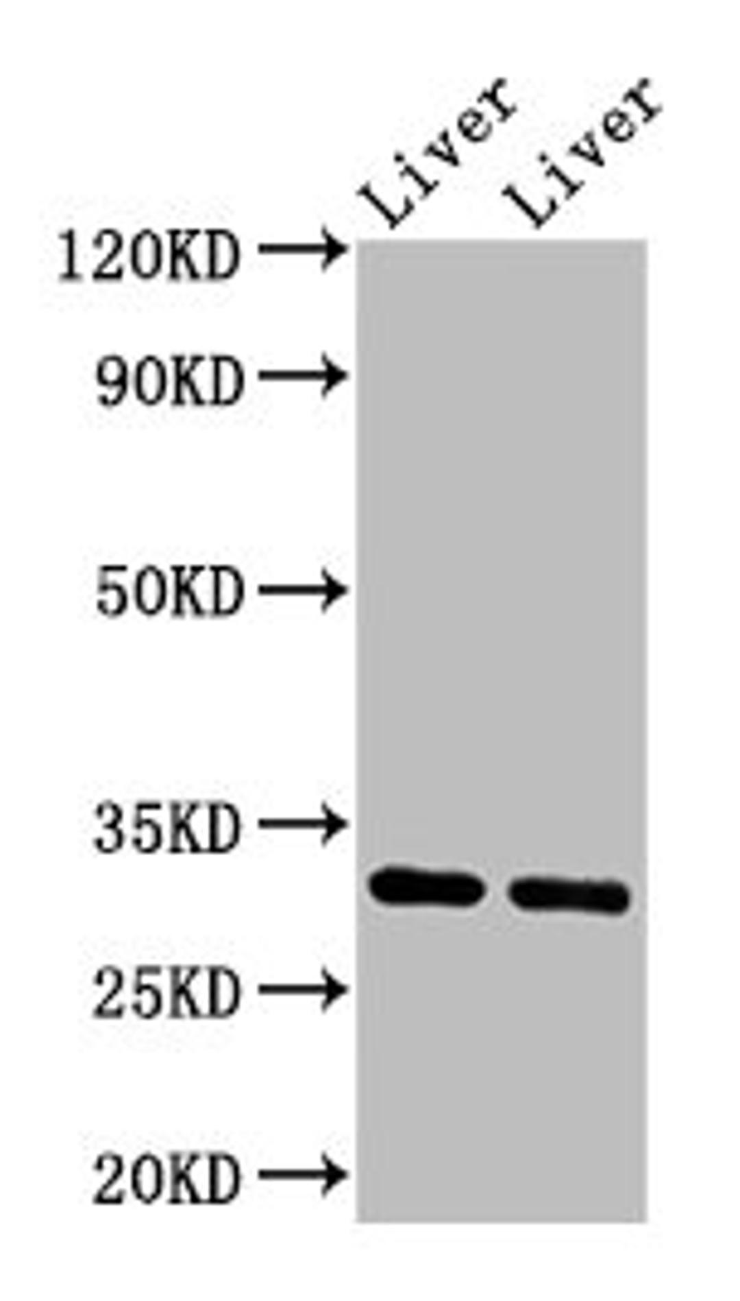 Western Blot. Positive WB detected in: Rat liver tissue, Mouse liver tissue. All lanes: APOA1 antibody at 3.4µg/ml. Secondary. Goat polyclonal to rabbit IgG at 1/50000 dilution. Predicted band size: 31 kDa. Observed band size: 31 kDa