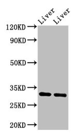 Western Blot. Positive WB detected in: Rat liver tissue, Mouse liver tissue. All lanes: APOA1 antibody at 3.4µg/ml. Secondary. Goat polyclonal to rabbit IgG at 1/50000 dilution. Predicted band size: 31 kDa. Observed band size: 31 kDa