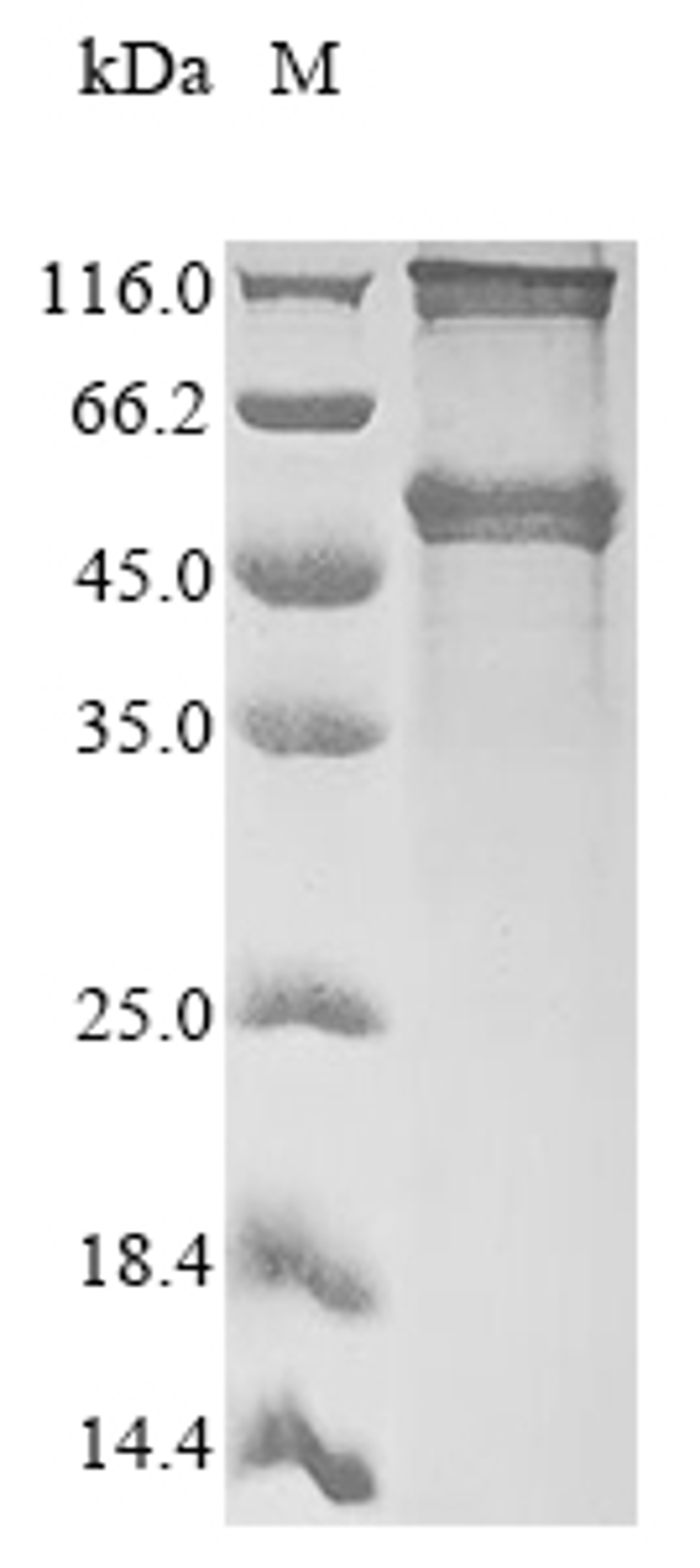 (Tris-Glycine gel) Discontinuous SDS-PAGE (reduced) with 5% enrichment gel and 15% separation gel.