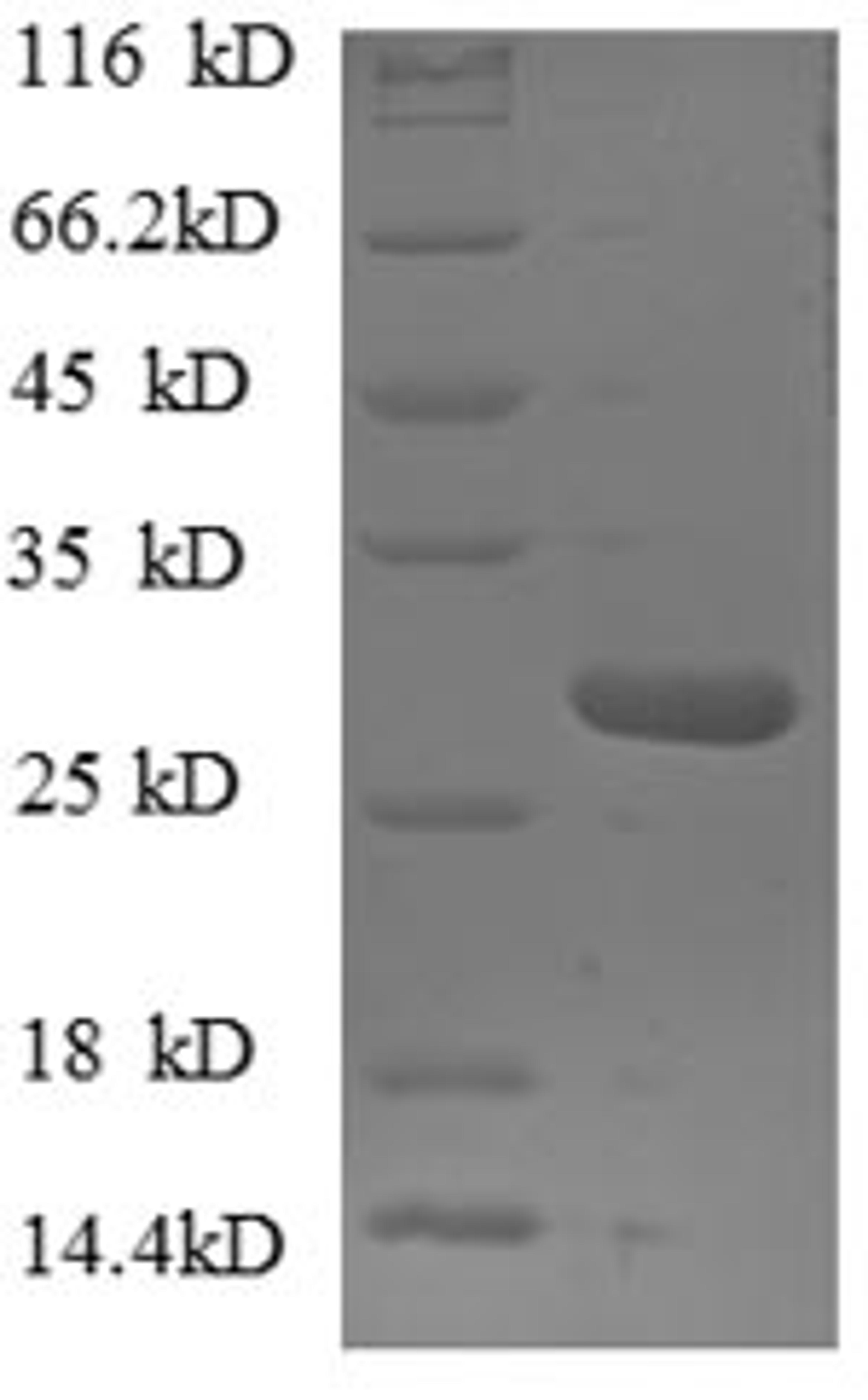 (Tris-Glycine gel) Discontinuous SDS-PAGE (reduced) with 5% enrichment gel and 15% separation gel.