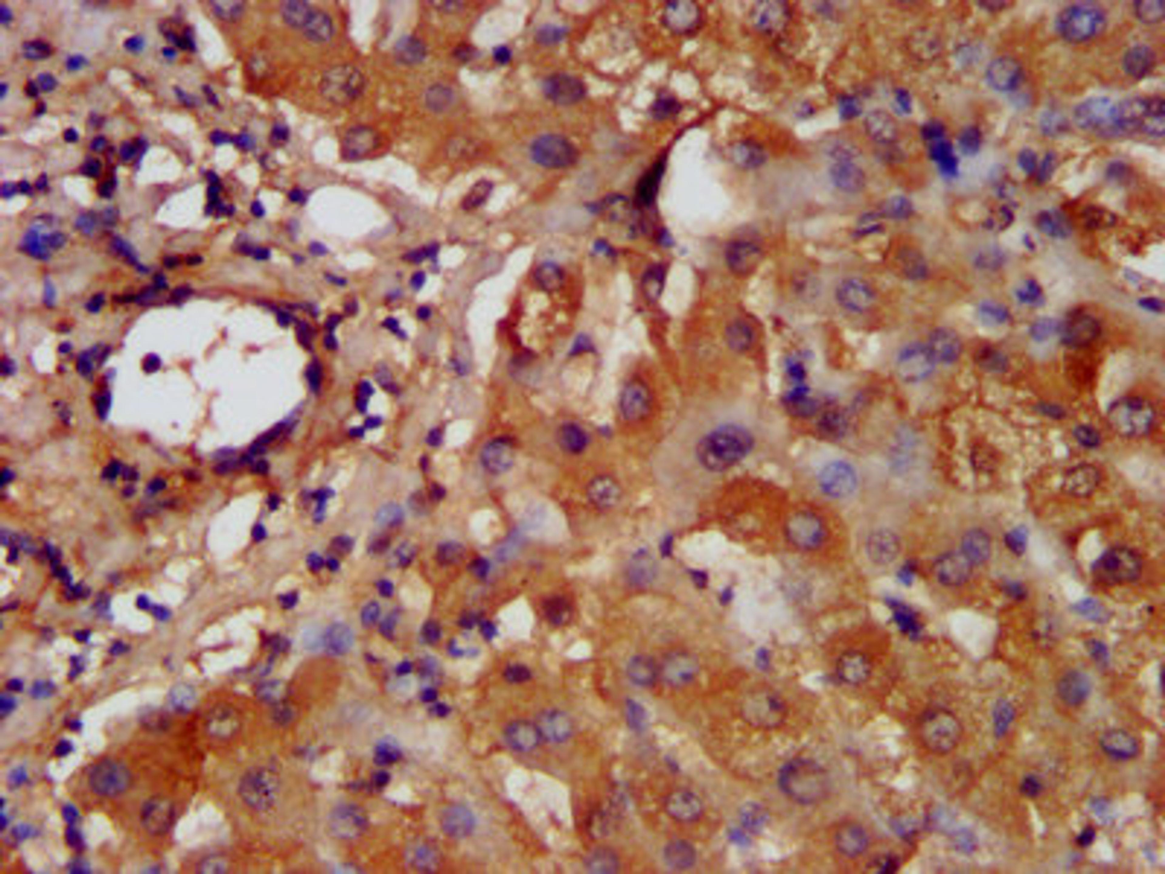 IHC image of CSB-PA010123LA01HU diluted at 1:200 and staining in paraffin-embedded human liver tissue performed on a Leica BondTM system. After dewaxing and hydration, antigen retrieval was mediated by high pressure in a citrate buffer (pH 6.0). Section was blocked with 10% normal goat serum 30min at RT. Then primary antibody (1% BSA) was incubated at 4&deg;C overnight. The primary is detected by a biotinylated secondary antibody and visualized using an HRP conjugated SP system.