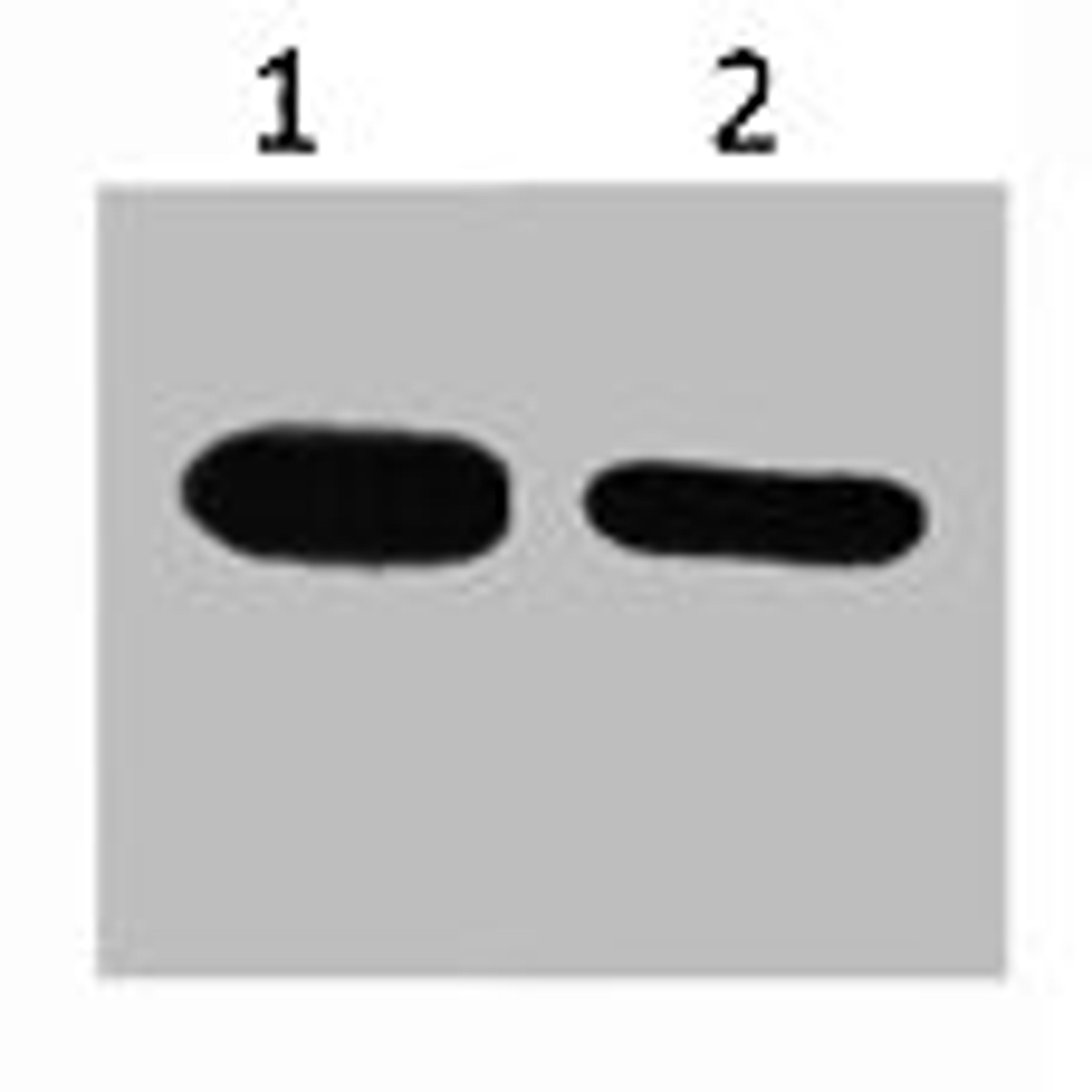 Western blot analysis of CBP recombinant protein, diluted at 1) 1:5000  2) 1:10000