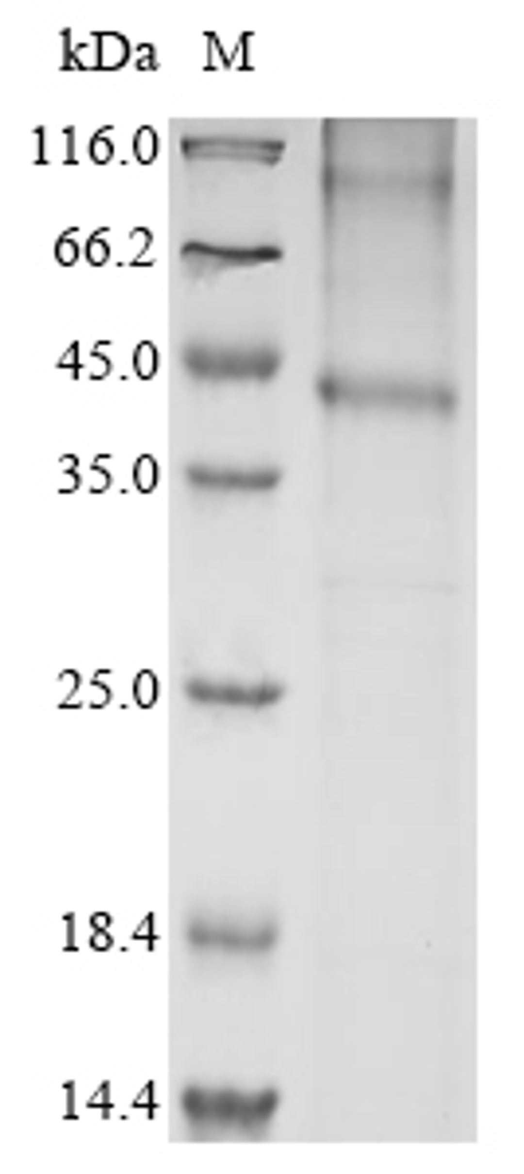 (Tris-Glycine gel) Discontinuous SDS-PAGE (reduced) with 5% enrichment gel and 15% separation gel.