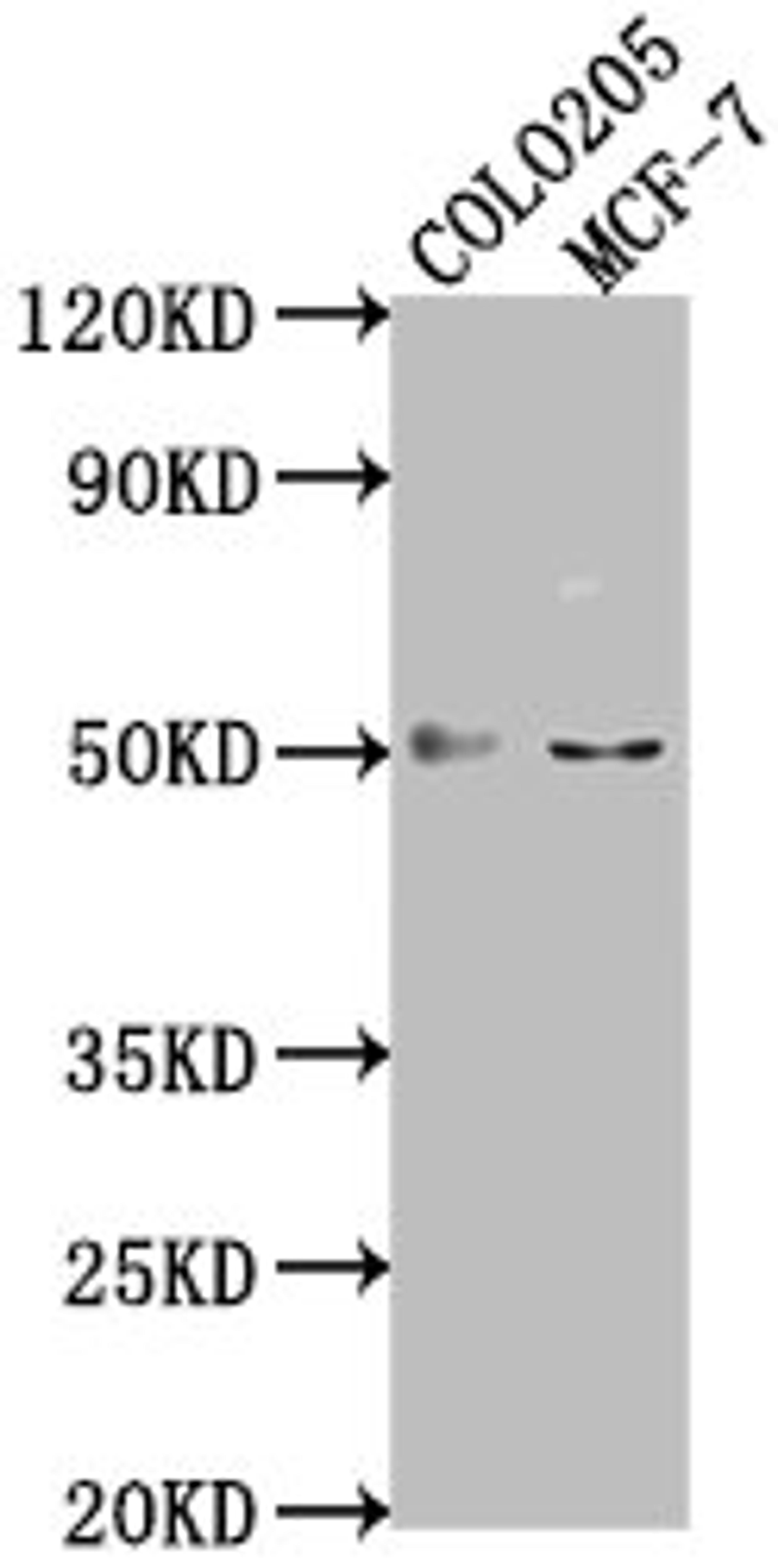 Western Blot. Positive WB detected in: COLO205 whole cell lysate, MCF-7 whole cell lysate. All lanes: LRAT antibody at 1:2000. Secondary. Goat polyclonal to rabbit IgG at 1/50000 dilution. Predicted band size: 26 kDa. Observed band size: 50 kDa.