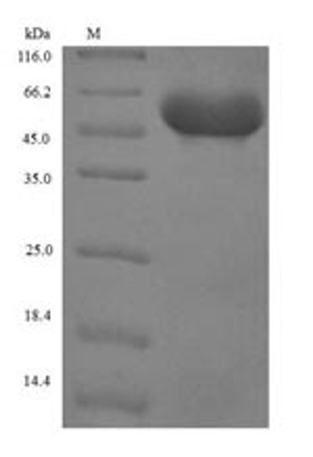 (Tris-Glycine gel) Discontinuous SDS-PAGE (reduced) with 5% enrichment gel and 15% separation gel.