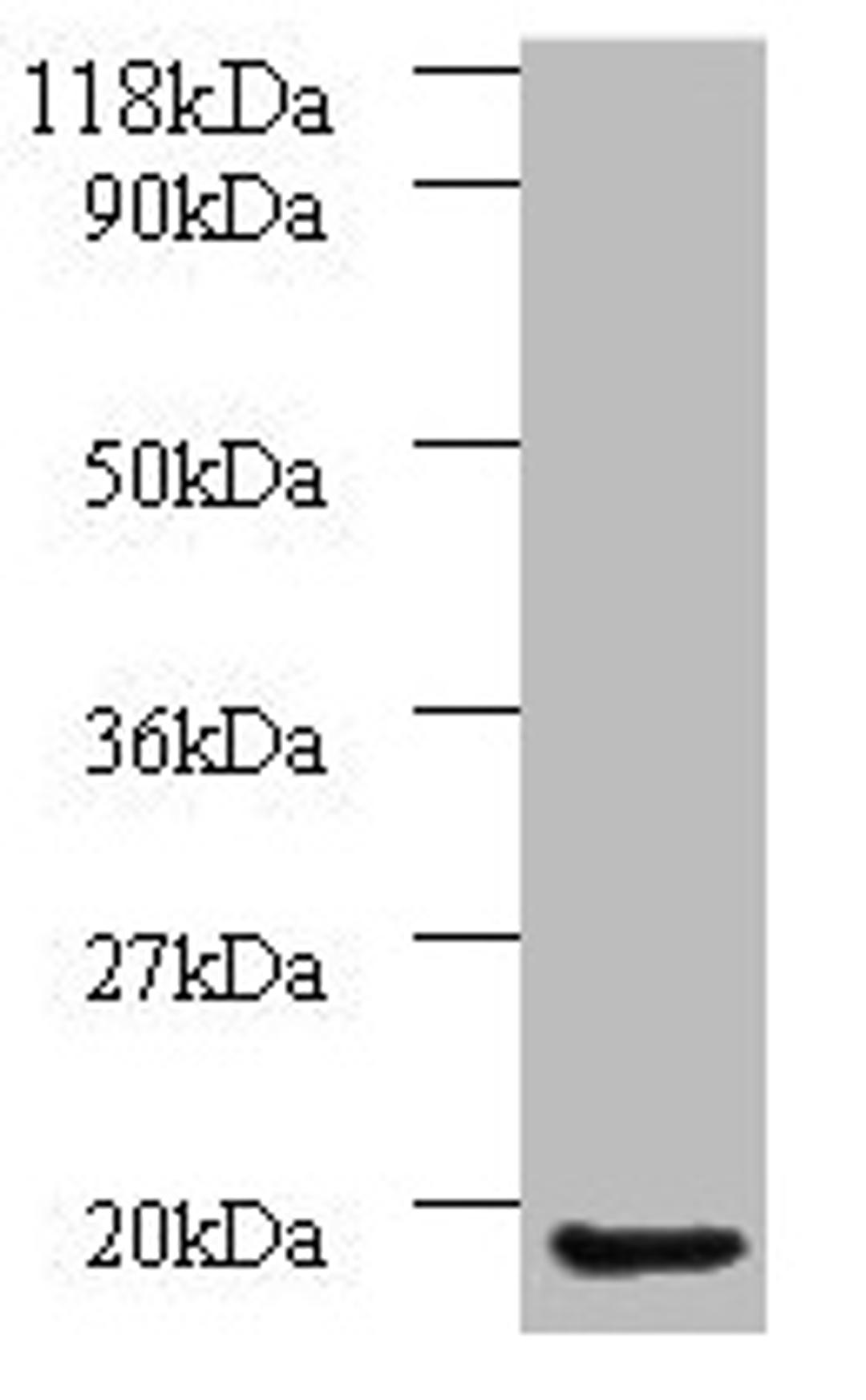 Western blot. All lanes: AP1S3 antibody at 2µg/ml + A549 whole cell lysate. Secondary. Goat polyclonal to rabbit IgG at 1/10000 dilution. Predicted band size: 19, 20, 13 kDa. Observed band size: 19 kDa