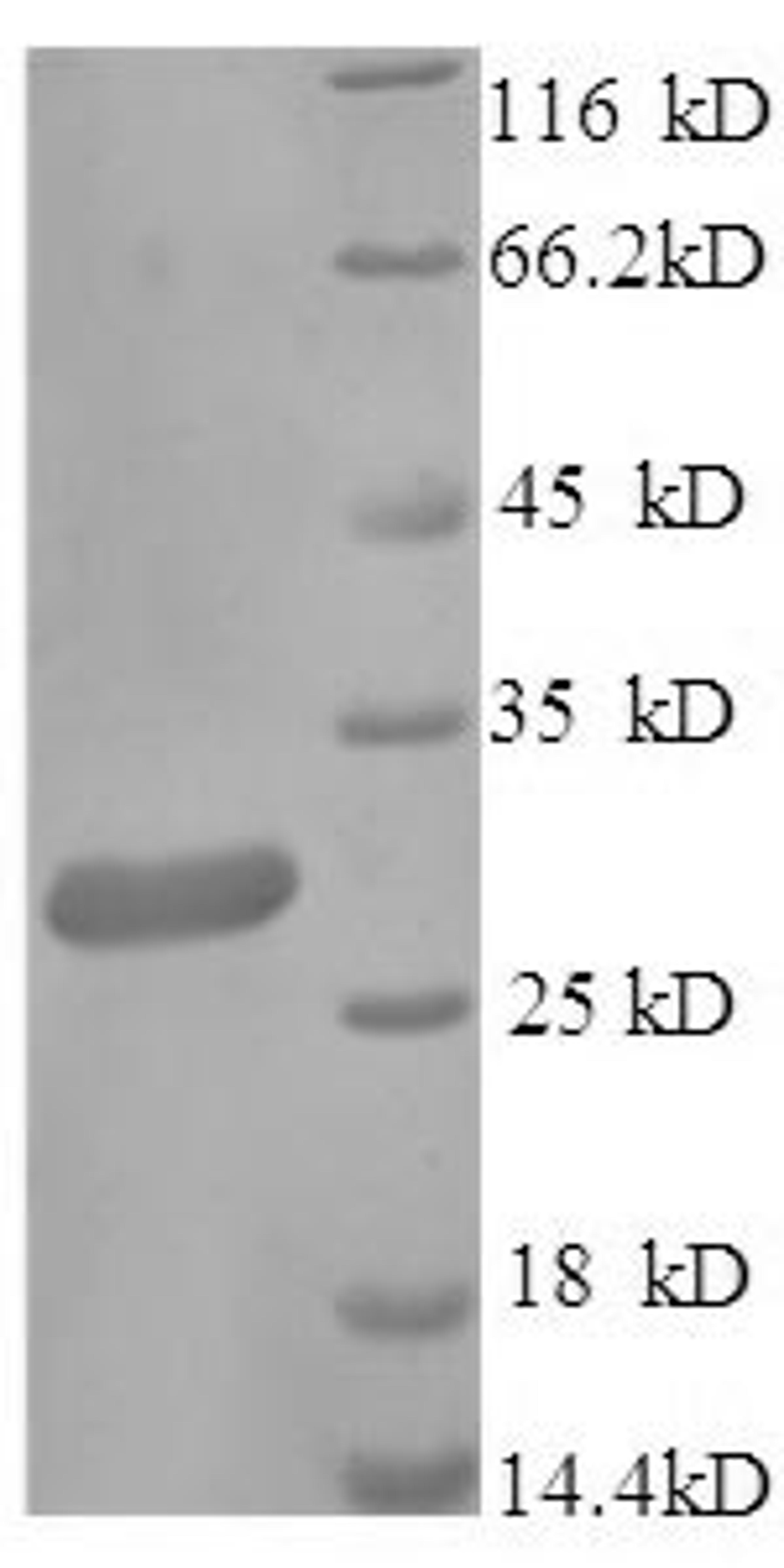 (Tris-Glycine gel) Discontinuous SDS-PAGE (reduced) with 5% enrichment gel and 15% separation gel.