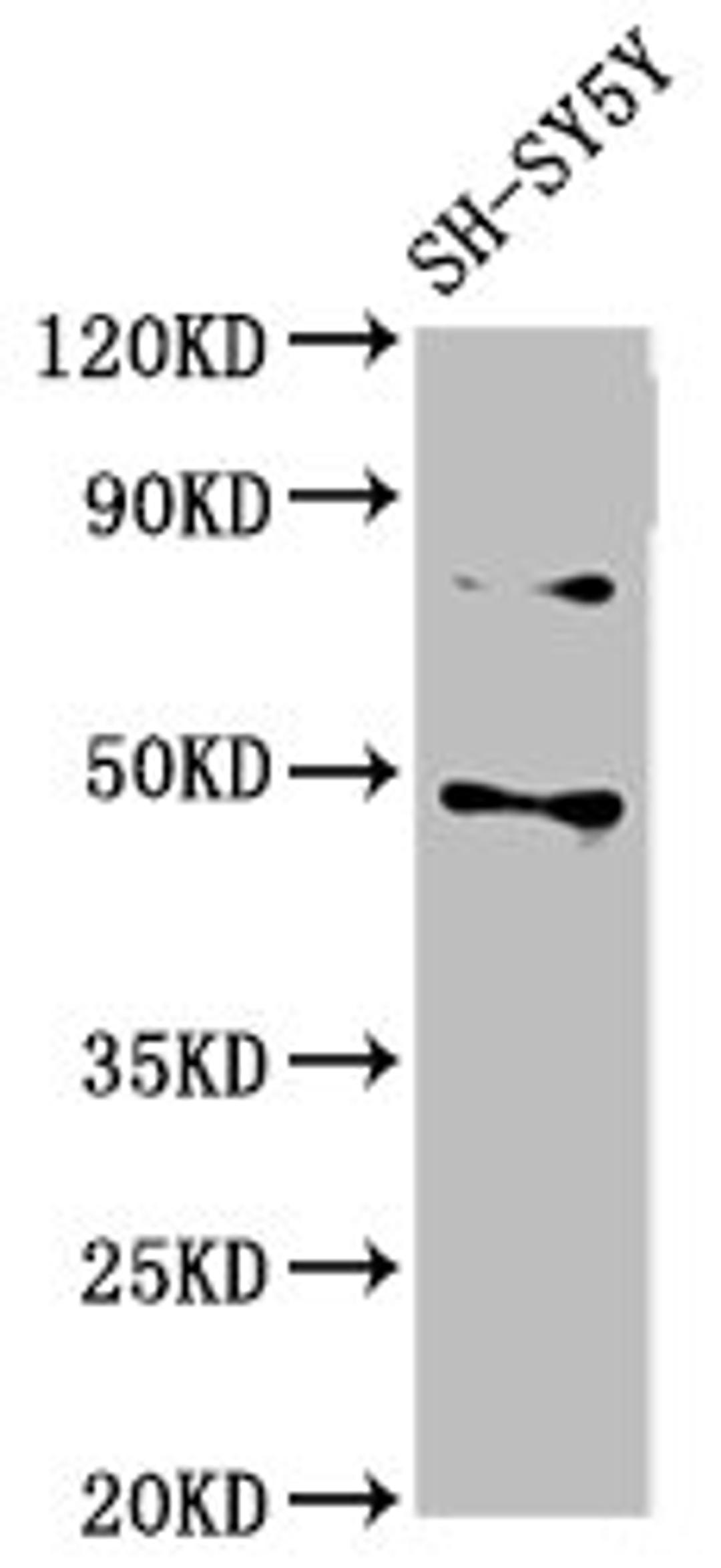 Western Blot. Positive WB detected in: SH-SY5Y whole cell lysate. All lanes: CSNK1E antibody at 3µg/ml. Secondary. Goat polyclonal to rabbit IgG at 1/50000 dilution. Predicted band size: 48 kDa. Observed band size: 48 kDa