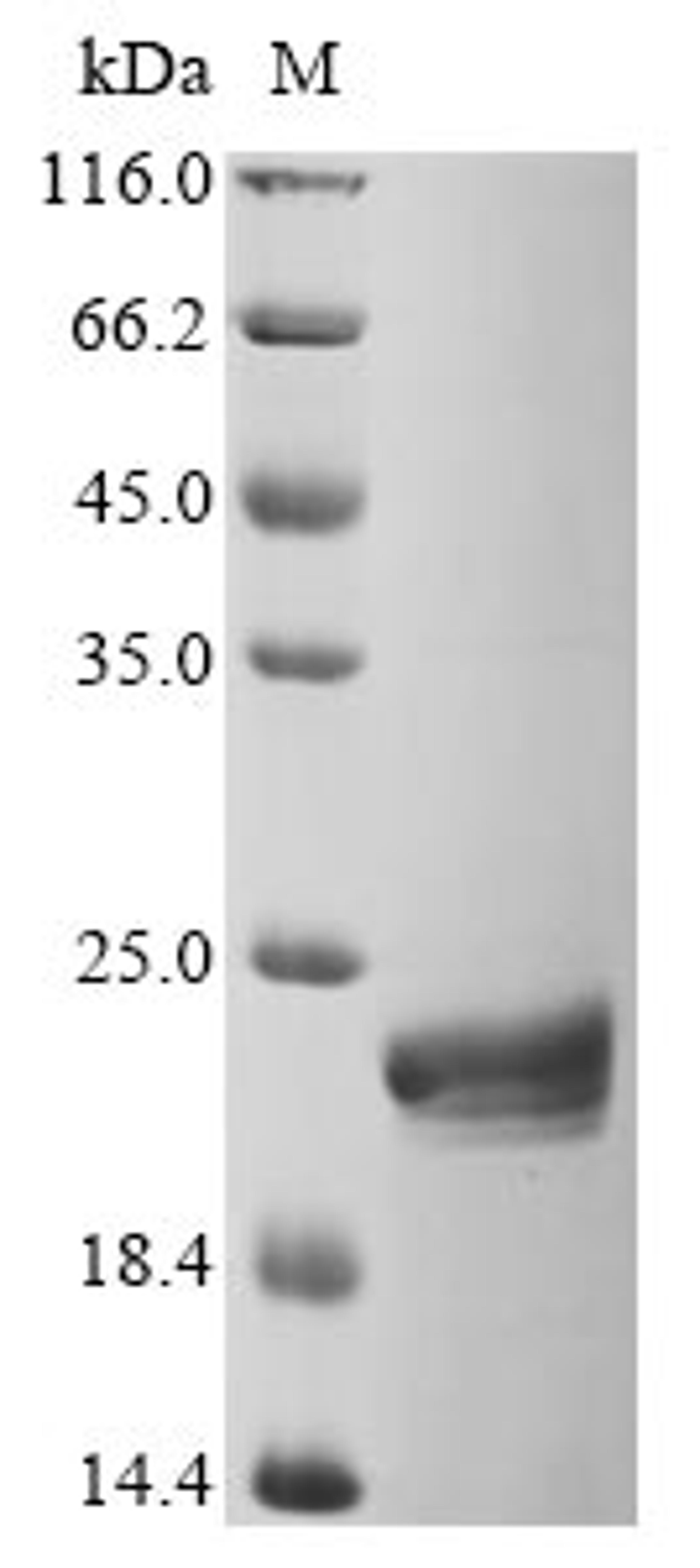 (Tris-Glycine gel) Discontinuous SDS-PAGE (reduced) with 5% enrichment gel and 15% separation gel.