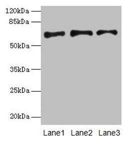 Western blot. All lanes: PLAT antibody at 16µg/ml. Lane 1: Jurkat whole cell lysate. Lane 2: Mouse stomach tissue. Lane 3: Mouse kidney tissue. Secondary. Goat polyclonal to rabbit IgG at 1/10000 dilution. Predicted band size: 63, 33, 58, 45 kDa. Observed band size: 63 kDa