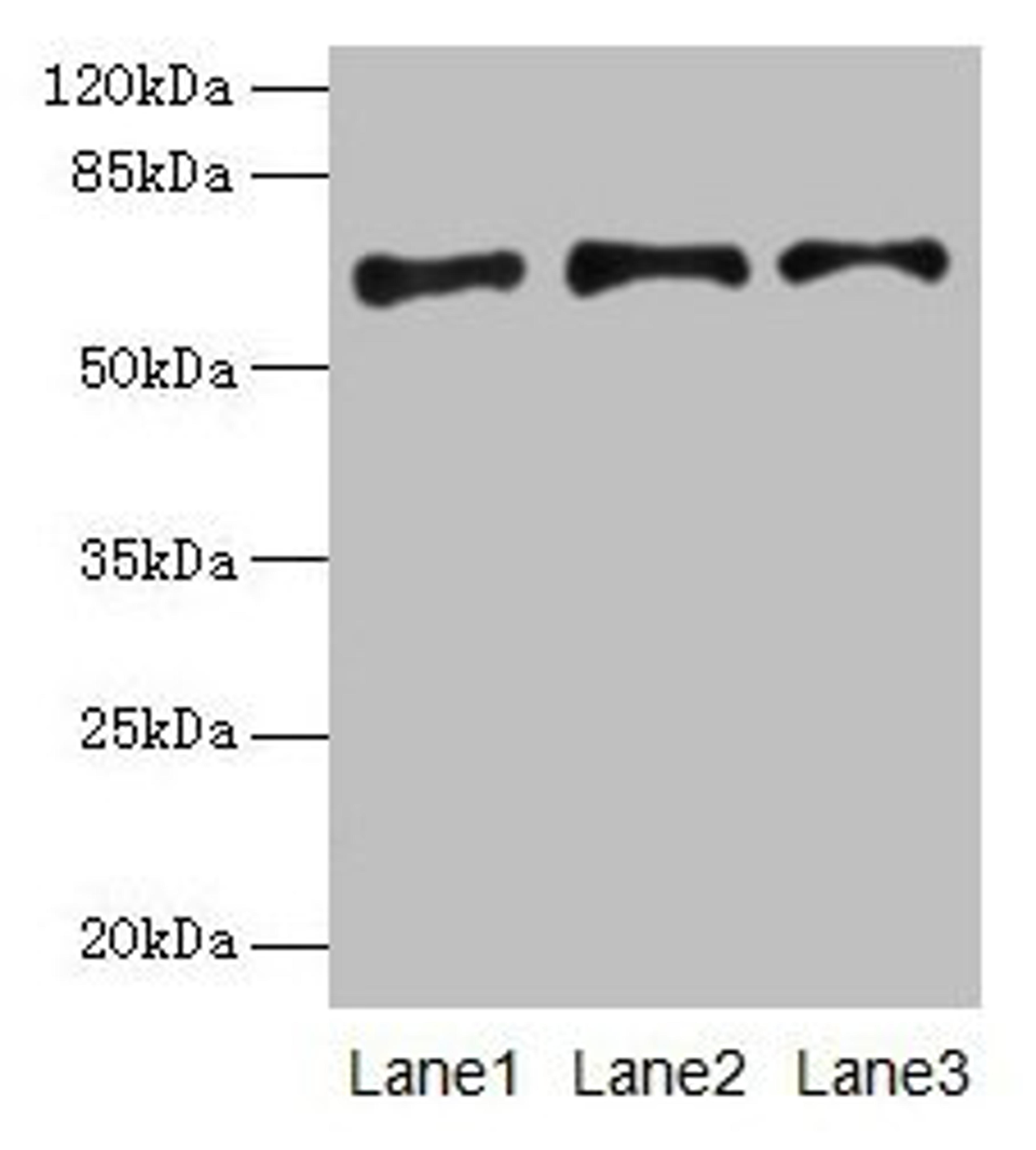 Western blot. All lanes: PLAT antibody at 16µg/ml. Lane 1: Jurkat whole cell lysate. Lane 2: Mouse stomach tissue. Lane 3: Mouse kidney tissue. Secondary. Goat polyclonal to rabbit IgG at 1/10000 dilution. Predicted band size: 63, 33, 58, 45 kDa. Observed band size: 63 kDa
