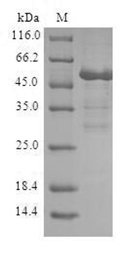 (Tris-Glycine gel) Discontinuous SDS-PAGE (reduced) with 5% enrichment gel and 15% separation gel.