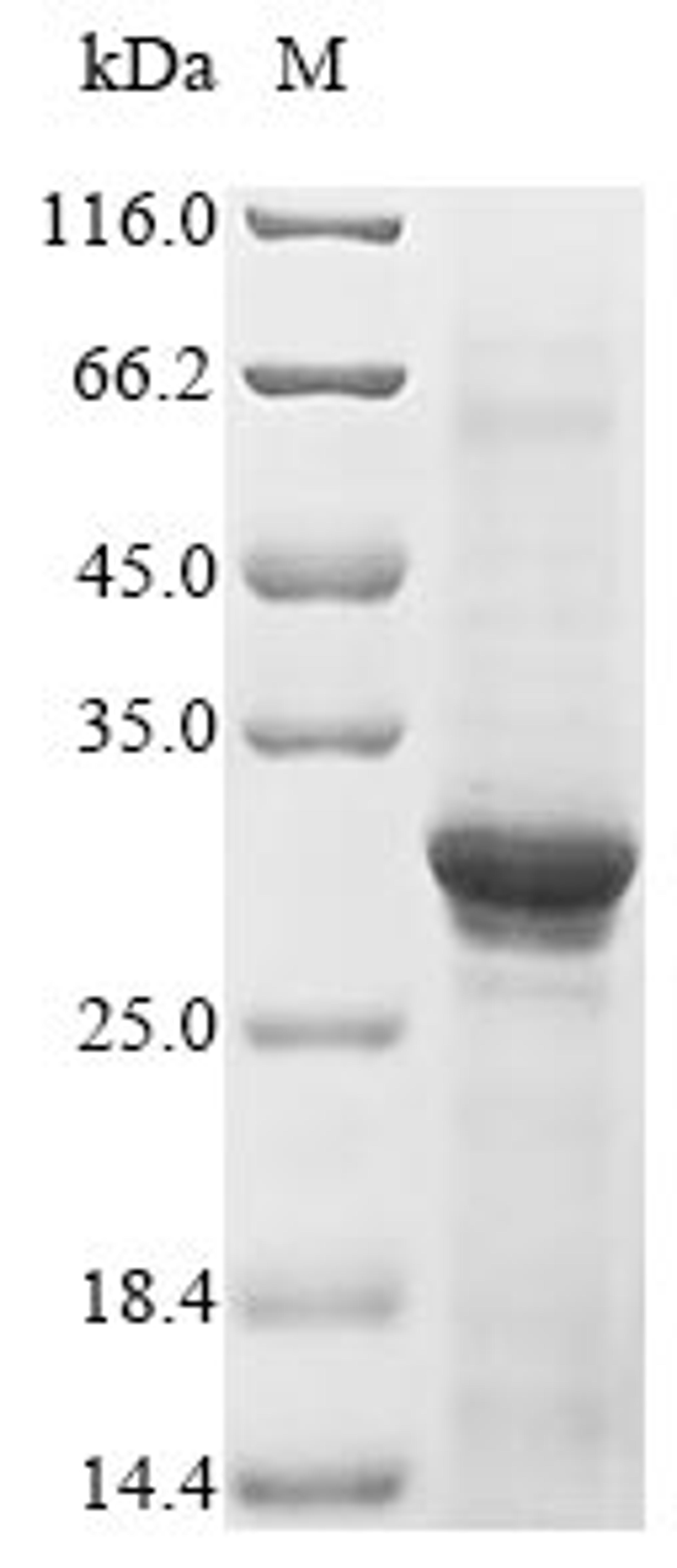 (Tris-Glycine gel) Discontinuous SDS-PAGE (reduced) with 5% enrichment gel and 15% separation gel.