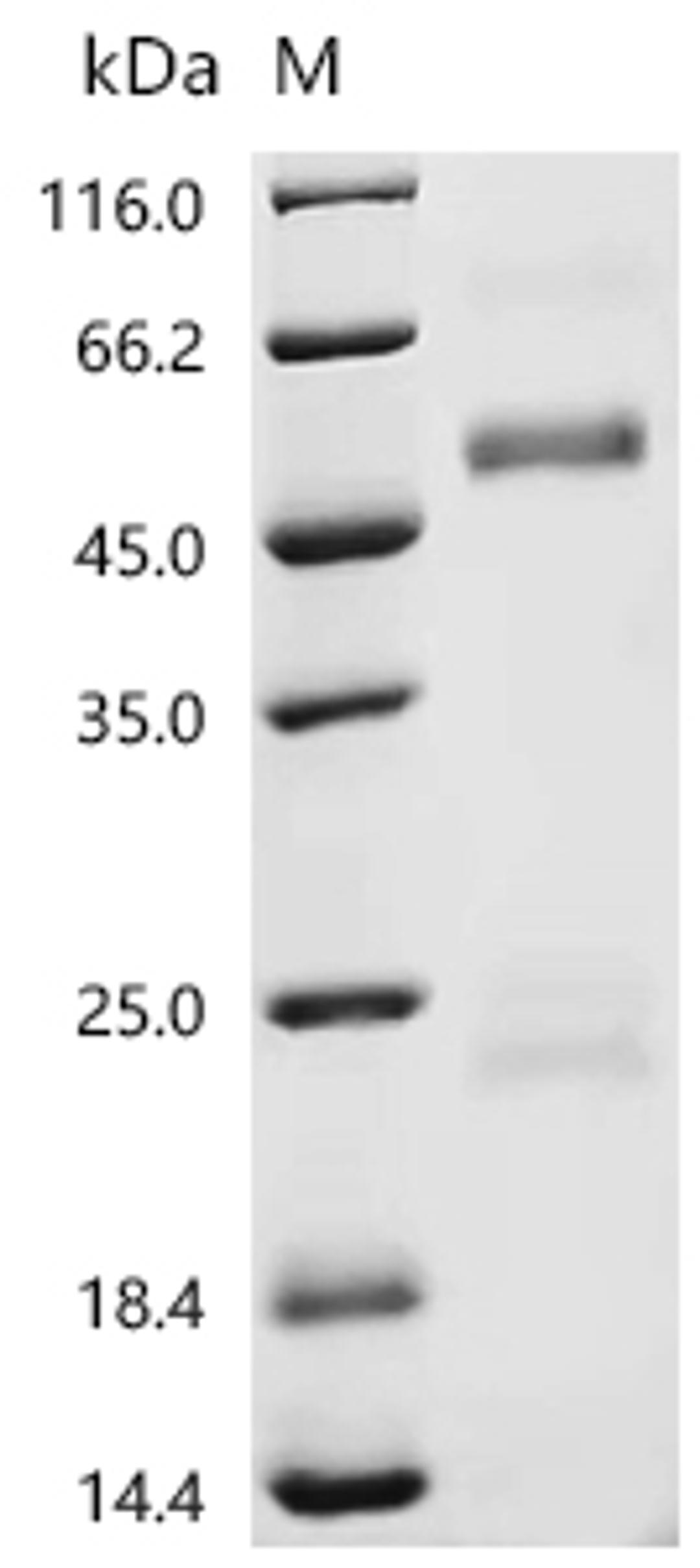 (Tris-Glycine gel) Discontinuous SDS-PAGE (reduced) with 5% enrichment gel and 15% separation gel.
