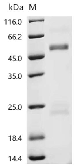 (Tris-Glycine gel) Discontinuous SDS-PAGE (reduced) with 5% enrichment gel and 15% separation gel.