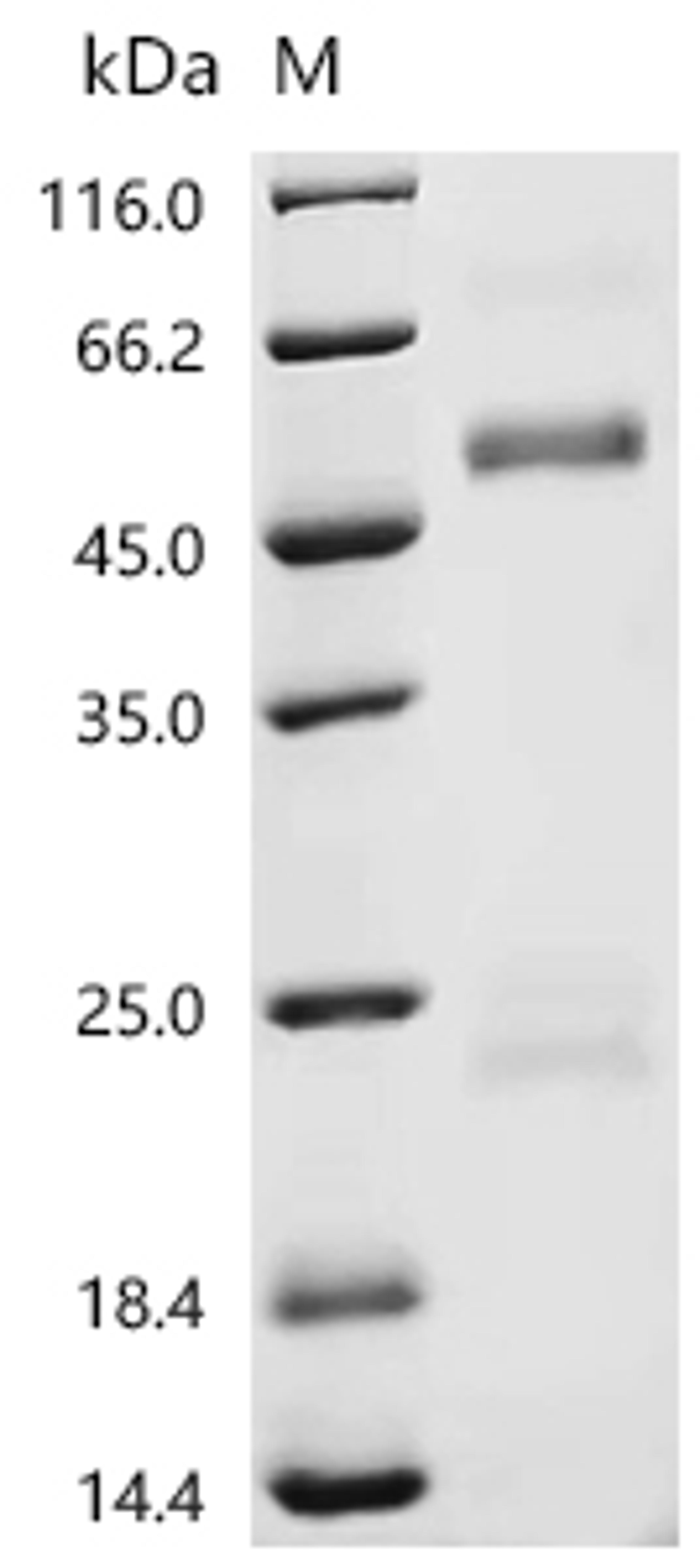 (Tris-Glycine gel) Discontinuous SDS-PAGE (reduced) with 5% enrichment gel and 15% separation gel.