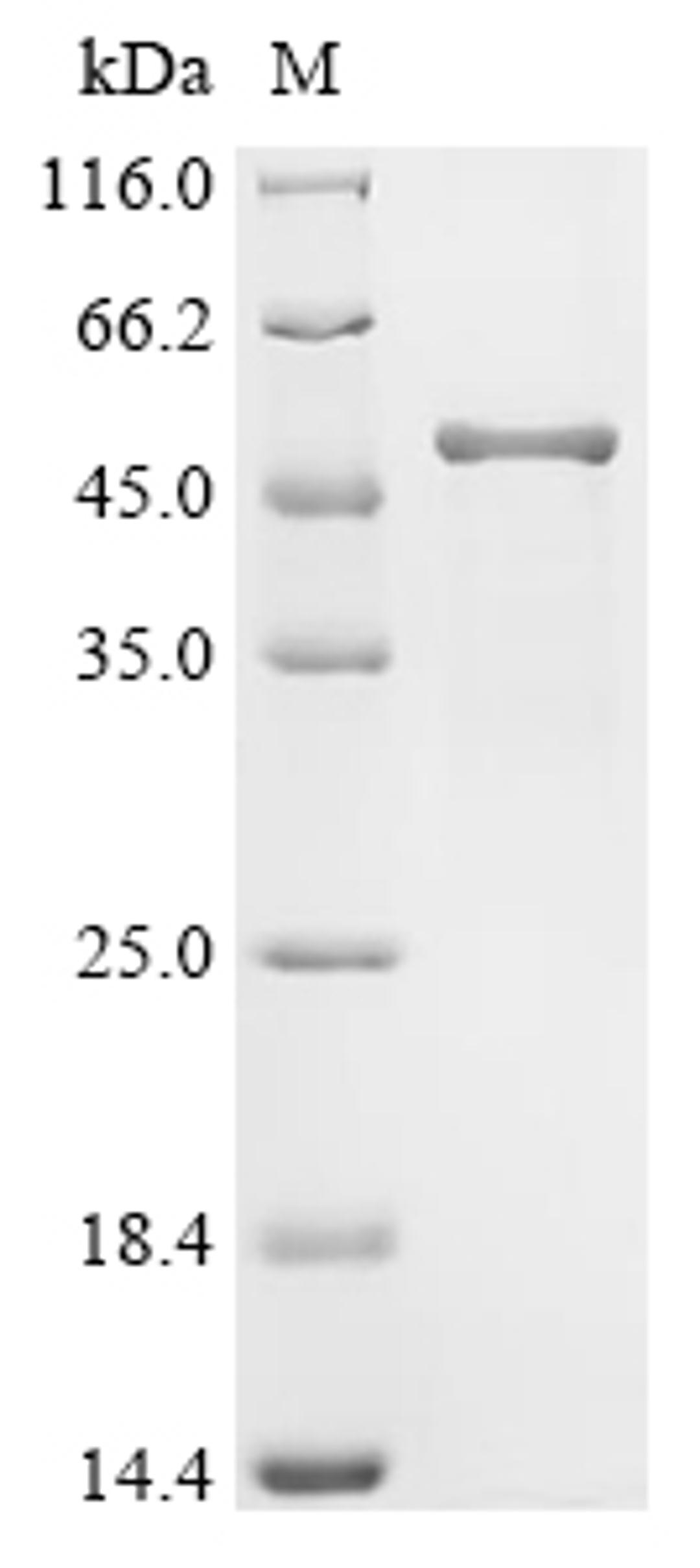 (Tris-Glycine gel) Discontinuous SDS-PAGE (reduced) with 5% enrichment gel and 15% separation gel.