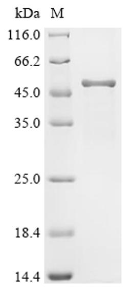 (Tris-Glycine gel) Discontinuous SDS-PAGE (reduced) with 5% enrichment gel and 15% separation gel.