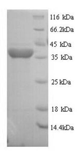 (Tris-Glycine gel) Discontinuous SDS-PAGE (reduced) with 5% enrichment gel and 15% separation gel.