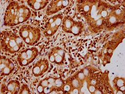 IHC image of CSB-PA010418OA23nbhbHU diluted at 1:20 and staining in paraffin-embedded human small intestine tissue performed on a Leica BondTM system. After dewaxing and hydration, antigen retrieval was mediated by high pressure in a citrate buffer (pH 6.0). Section was blocked with 10% normal goat serum 30min at RT. Then primary antibody (1% BSA) was incubated at 4°C overnight. The primary is detected by a biotinylated secondary antibody and visualized using an HRP conjugated SP system.