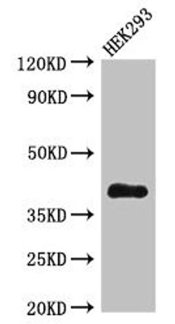Western Blot. Positive WB detected in: HEK293 whole cell lysate. All lanes: DHRS13 antibody at 4µg/ml. Secondary. Goat polyclonal to rabbit IgG at 1/50000 dilution. Predicted band size: 41, 36, 33 kDa. Observed band size: 41 kDa