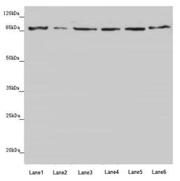 Western blot. All lanes: YME1L1 antibody at 3.8µg/ml. Lane 1: A549 whole cell lysate. Lane 2: Jurkat whole cell lysate. Lane 3: A431 whole cell lysate. Lane 4: Hela whole cell lysate. Lane 5: HepG2 whole cell lysate. Lane 6: MCF-7 whole cell lysate. Secondary. Goat polyclonal to rabbit IgG at 1/10000 dilution. Predicted band size: 87, 80, 76 kDa. Observed band size: 87 kDa