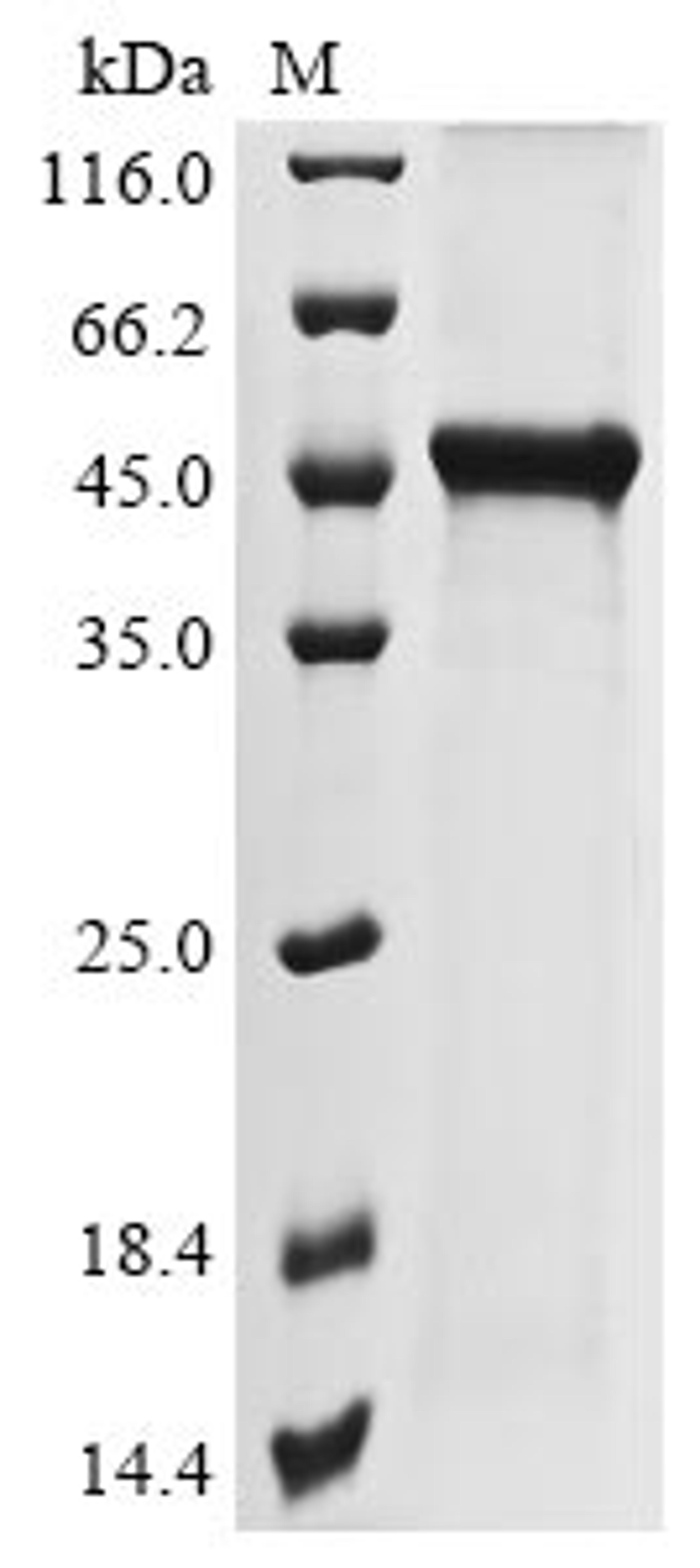 (Tris-Glycine gel) Discontinuous SDS-PAGE (reduced) with 5% enrichment gel and 15% separation gel.