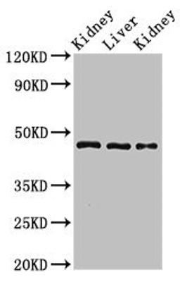 Western Blot. Positive WB detected in: Rat kidney tissue, Rat liver tissue, Mouse kidney tissue. All lanes: MKRN2 antibody at 3ug/ml. Secondary. Goat polyclonal to rabbit IgG at 1/50000 dilution. Predicted band size: 47, 42 kDa. Observed band size: 47 kDa. 