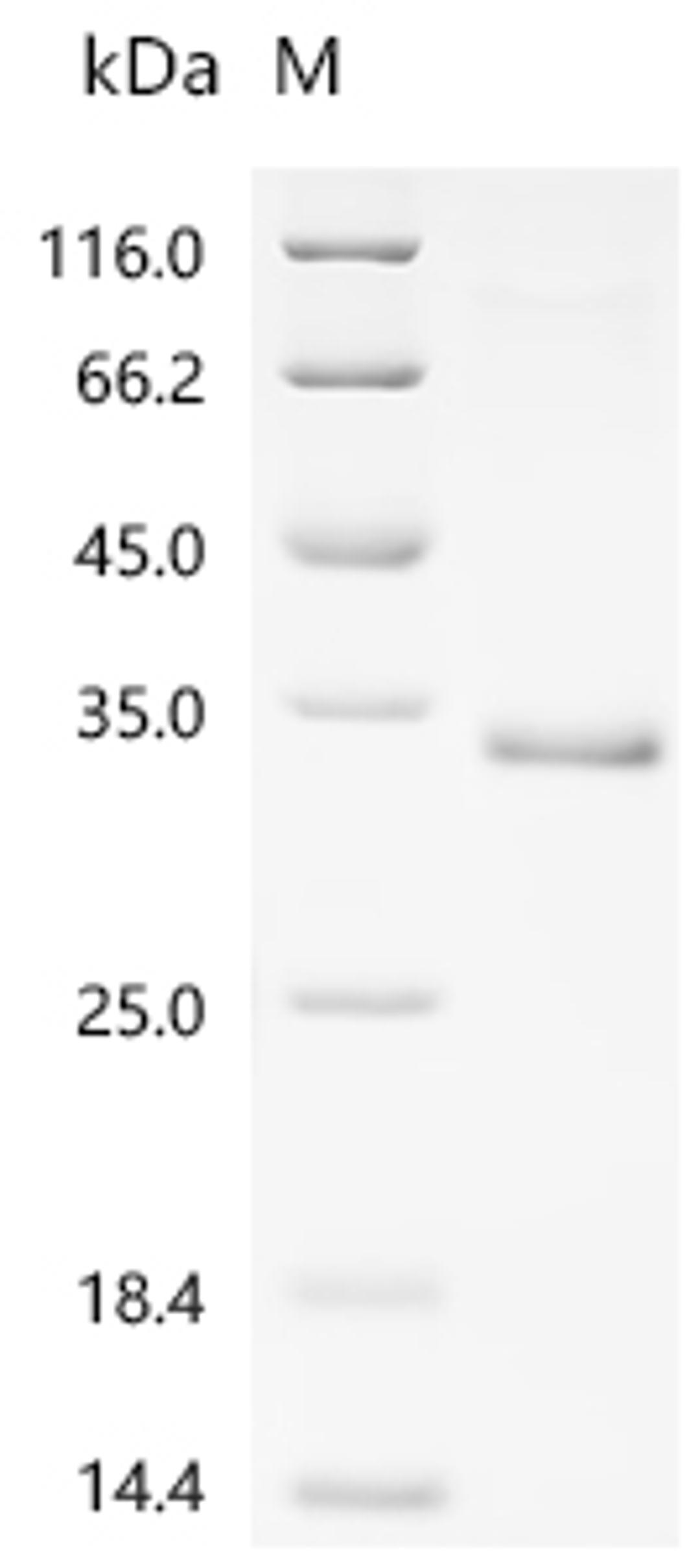 (Tris-Glycine gel) Discontinuous SDS-PAGE (reduced) with 5% enrichment gel and 15% separation gel.