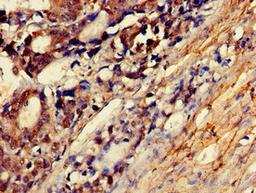 Immunohistochemistry of paraffin-embedded human smooth muscle tissue using CSB-PA618995LA01HU at dilution of 1:100