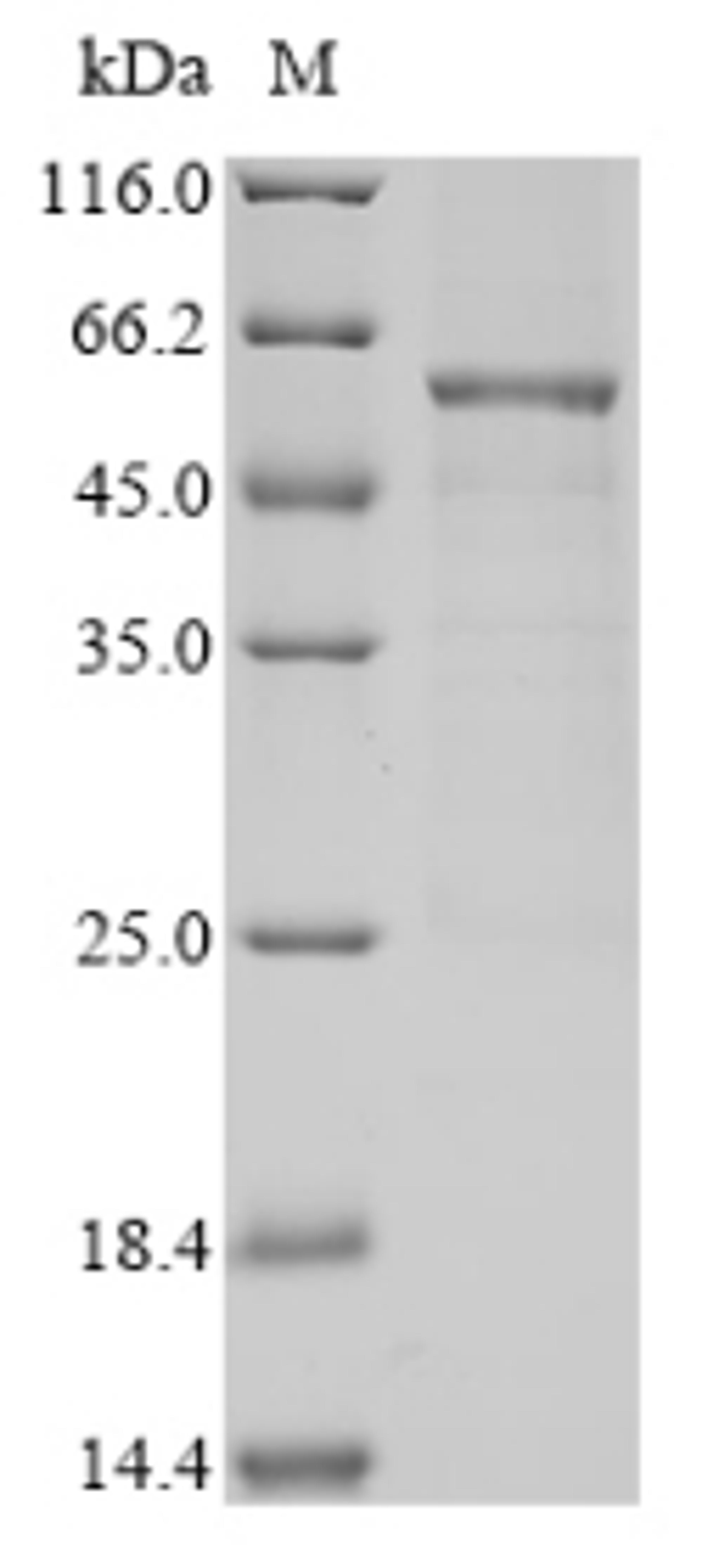 (Tris-Glycine gel) Discontinuous SDS-PAGE (reduced) with 5% enrichment gel and 15% separation gel.