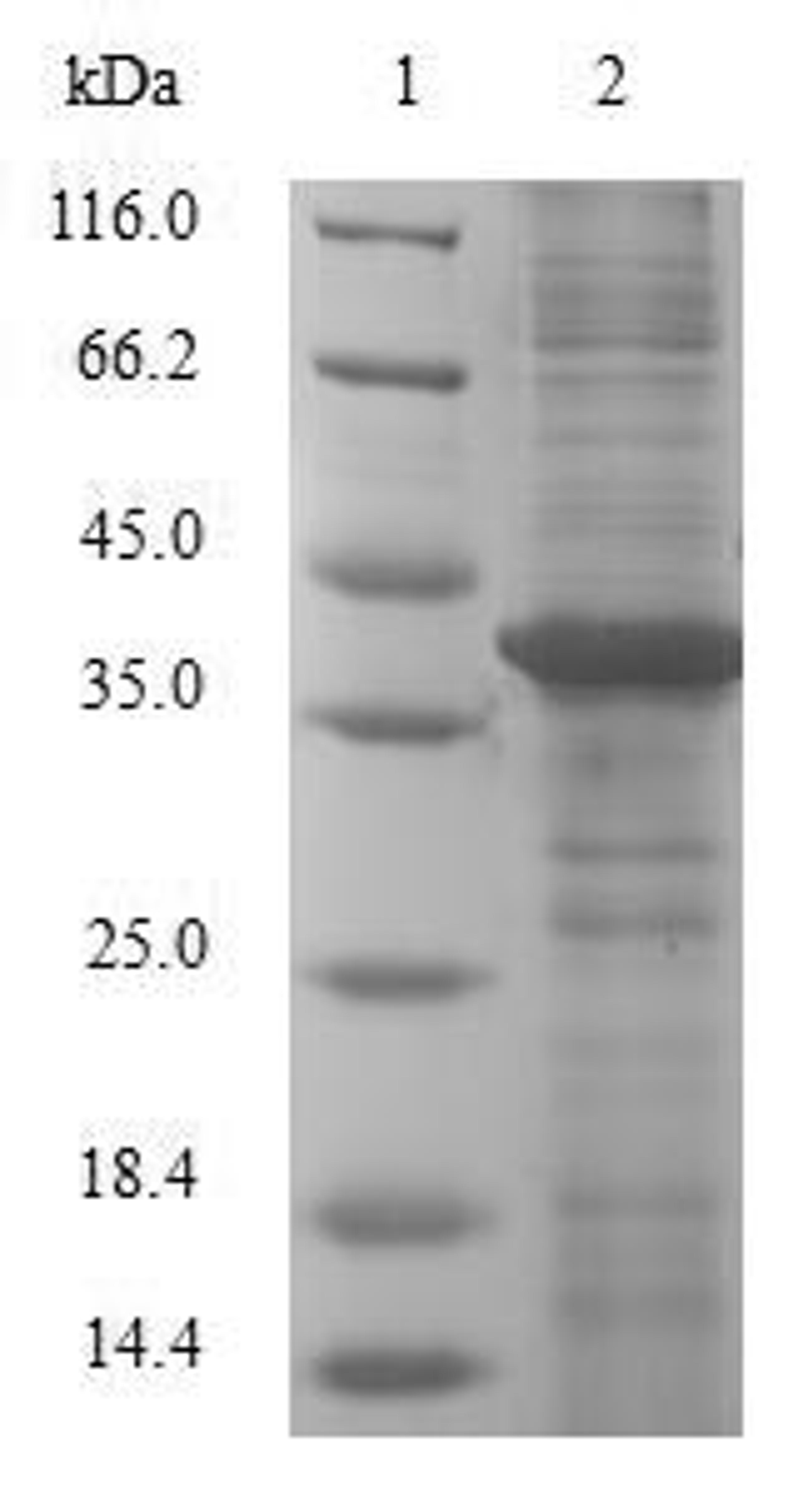 (Tris-Glycine gel) Discontinuous SDS-PAGE (reduced) with 5% enrichment gel and 15% separation gel.