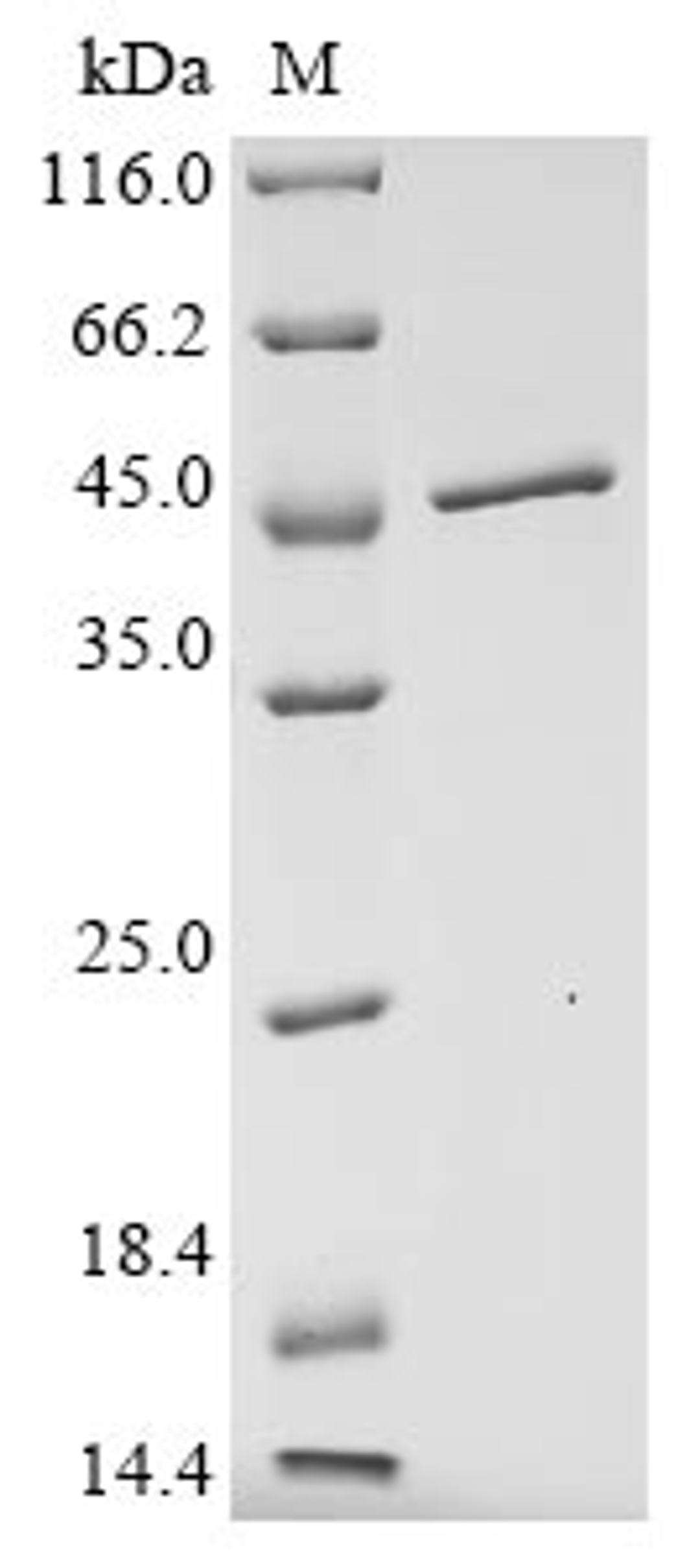 (Tris-Glycine gel) Discontinuous SDS-PAGE (reduced) with 5% enrichment gel and 15% separation gel.
