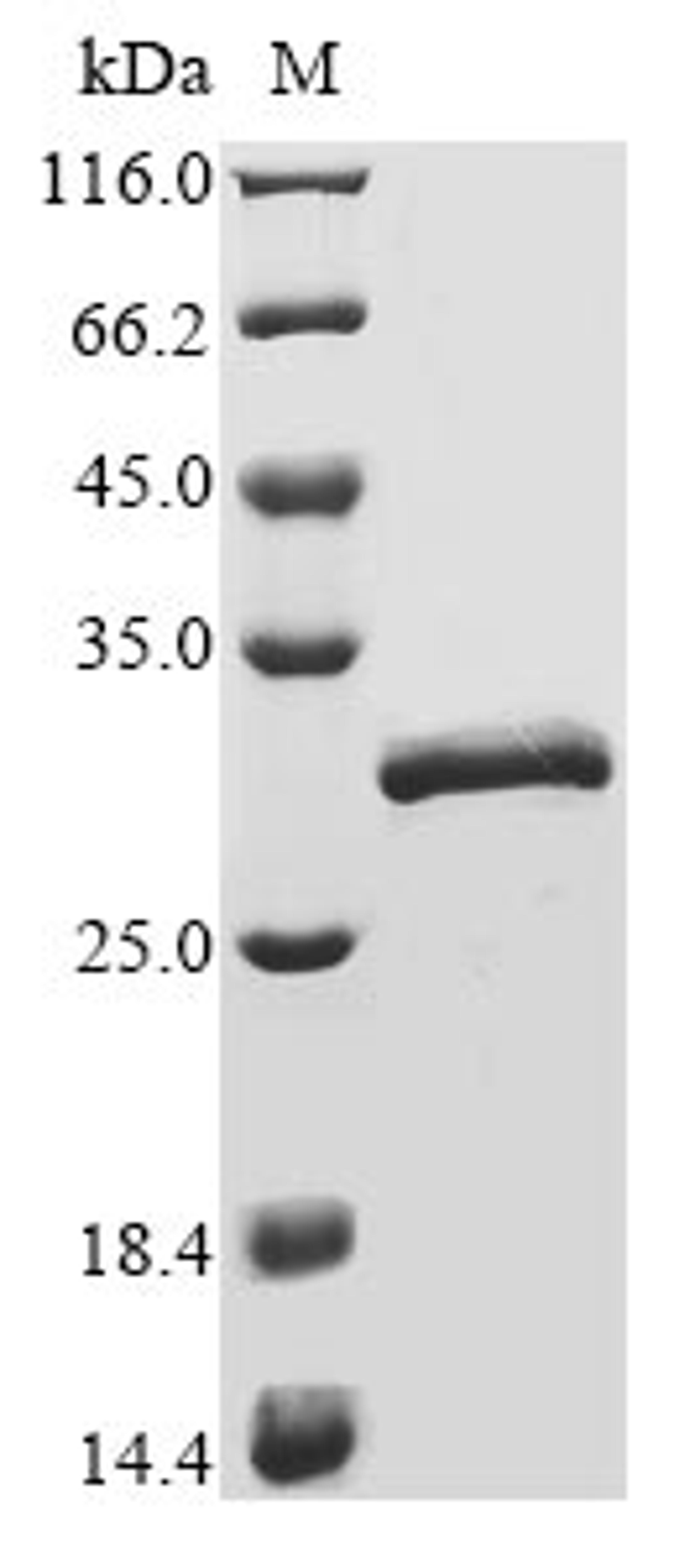 (Tris-Glycine gel) Discontinuous SDS-PAGE (reduced) with 5% enrichment gel and 15% separation gel.
