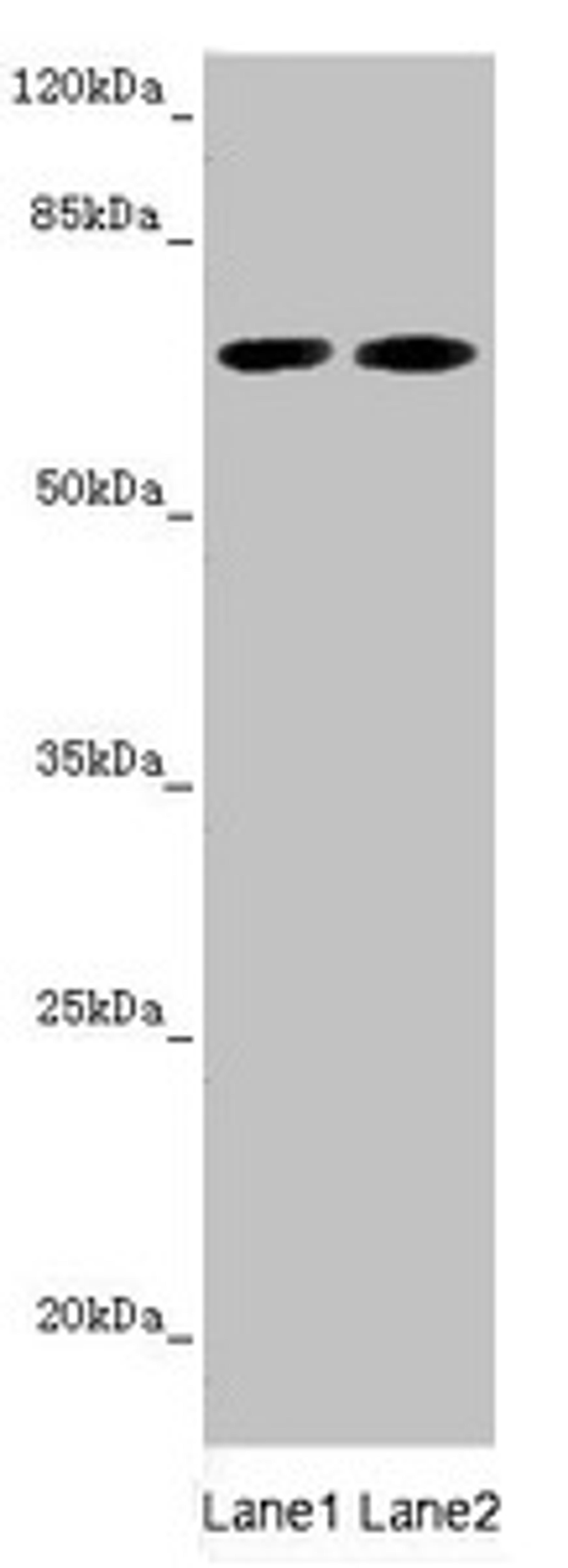 Western blot. All lanes: STXBP2 antibody at 5.88µg/ml. Lane 1: Mouse brain tissue. Lane 2: A549 whole cell lysate. Secondary. Goat polyclonal to rabbit IgG at 1/10000 dilution. Predicted band size: 67, 68 kDa. Observed band size: 67 kDa