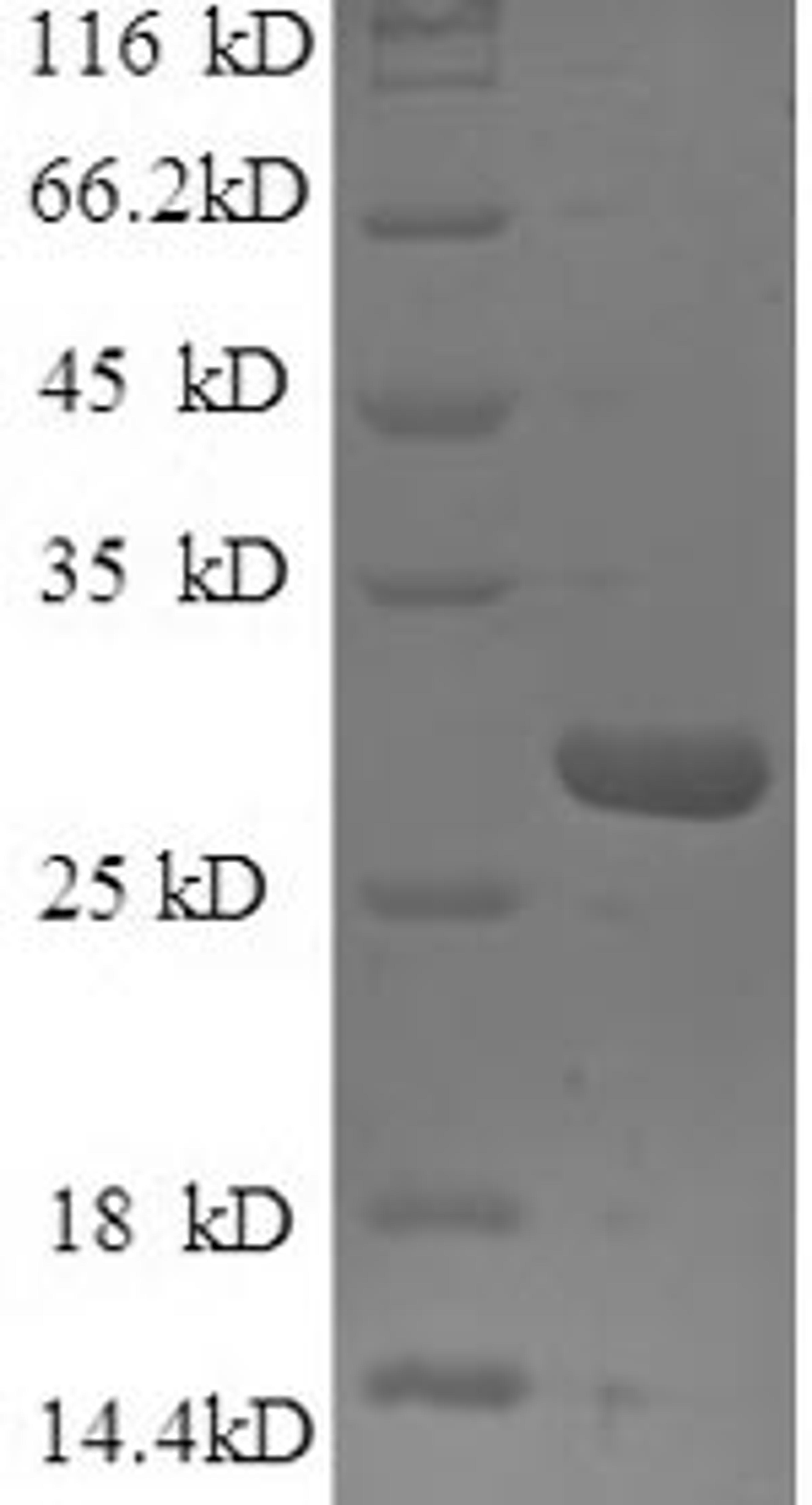 (Tris-Glycine gel) Discontinuous SDS-PAGE (reduced) with 5% enrichment gel and 15% separation gel.
