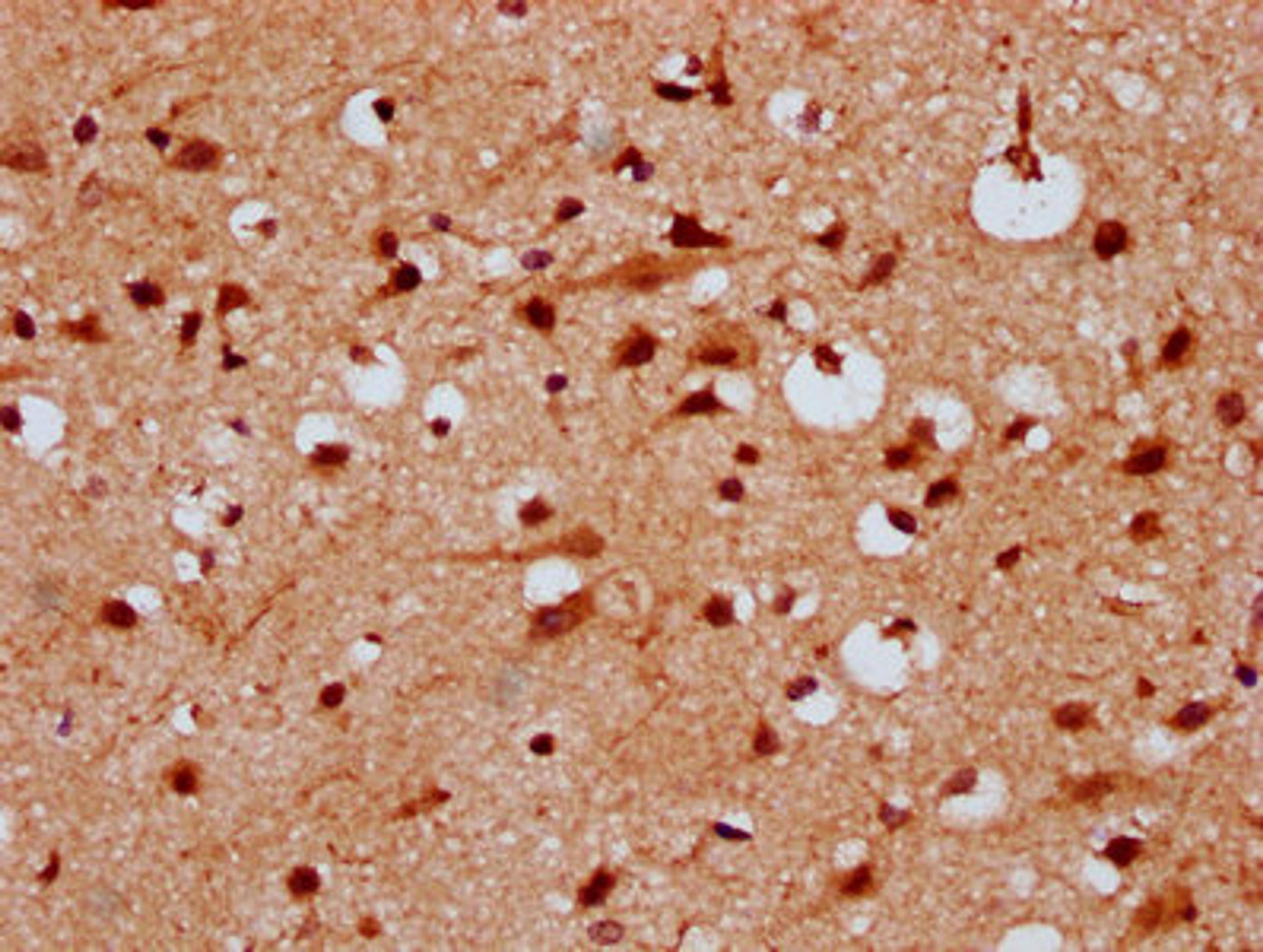 IHC image of CSB-PA22879A0Rb diluted at 1:300 and staining in paraffin-embedded human brain tissue performed on a Leica BondTM system. After dewaxing and hydration, antigen retrieval was mediated by high pressure in a citrate buffer (pH 6.0). Section was blocked with 10% normal goat serum 30min at RT. Then primary antibody (1% BSA) was incubated at 4&deg;C overnight. The primary is detected by a biotinylated secondary antibody and visualized using an HRP conjugated SP system.