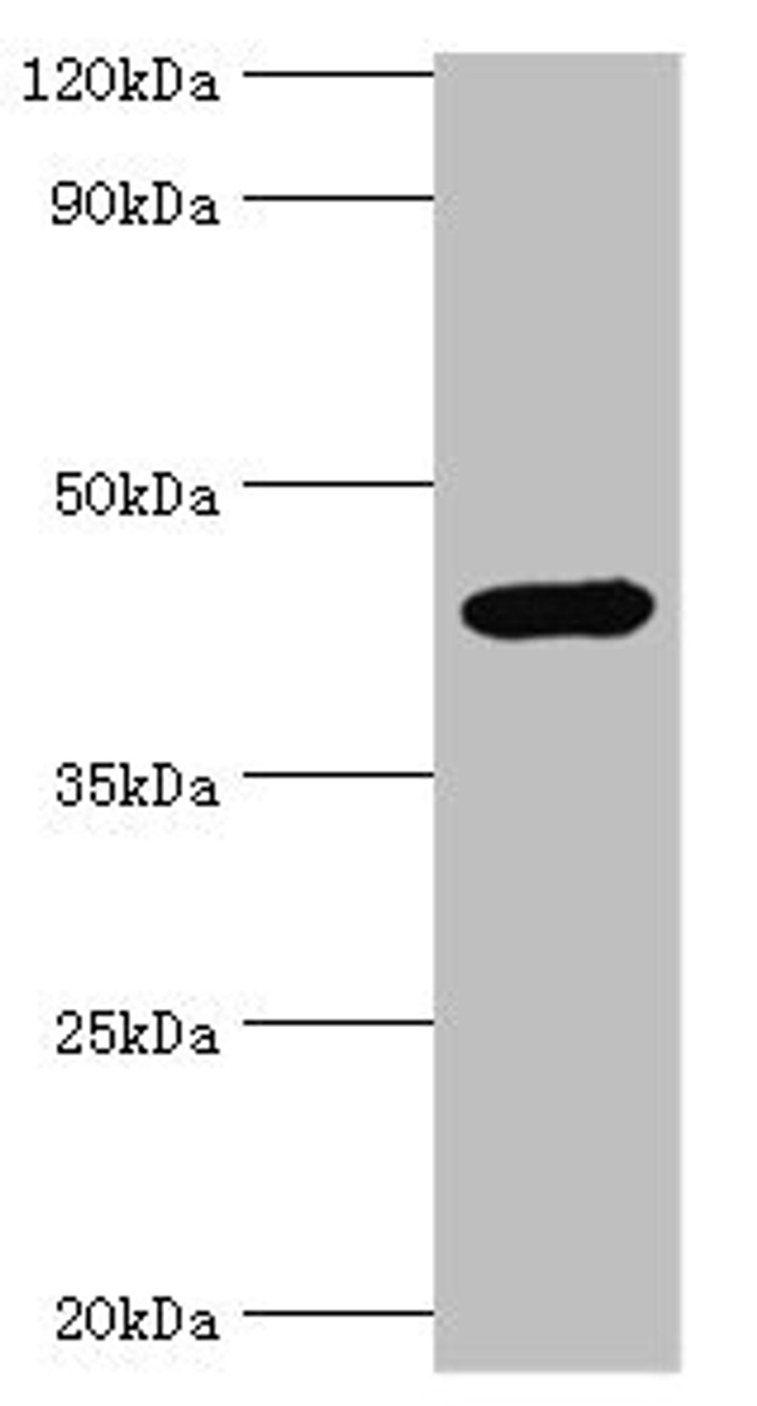 Western blot. All lanes: Interleukin-1 receptor type 2 antibody at 3ug/ml + Mouse kidney tissue. Secondary. Goat polyclonal to rabbit IgG at 1/10000 dilution. Predicted band size: 46, 34 kDa. Observed band size: 46 kDa. 