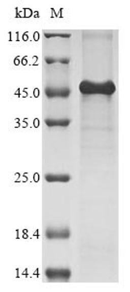 (Tris-Glycine gel) Discontinuous SDS-PAGE (reduced) with 5% enrichment gel and 15% separation gel.
