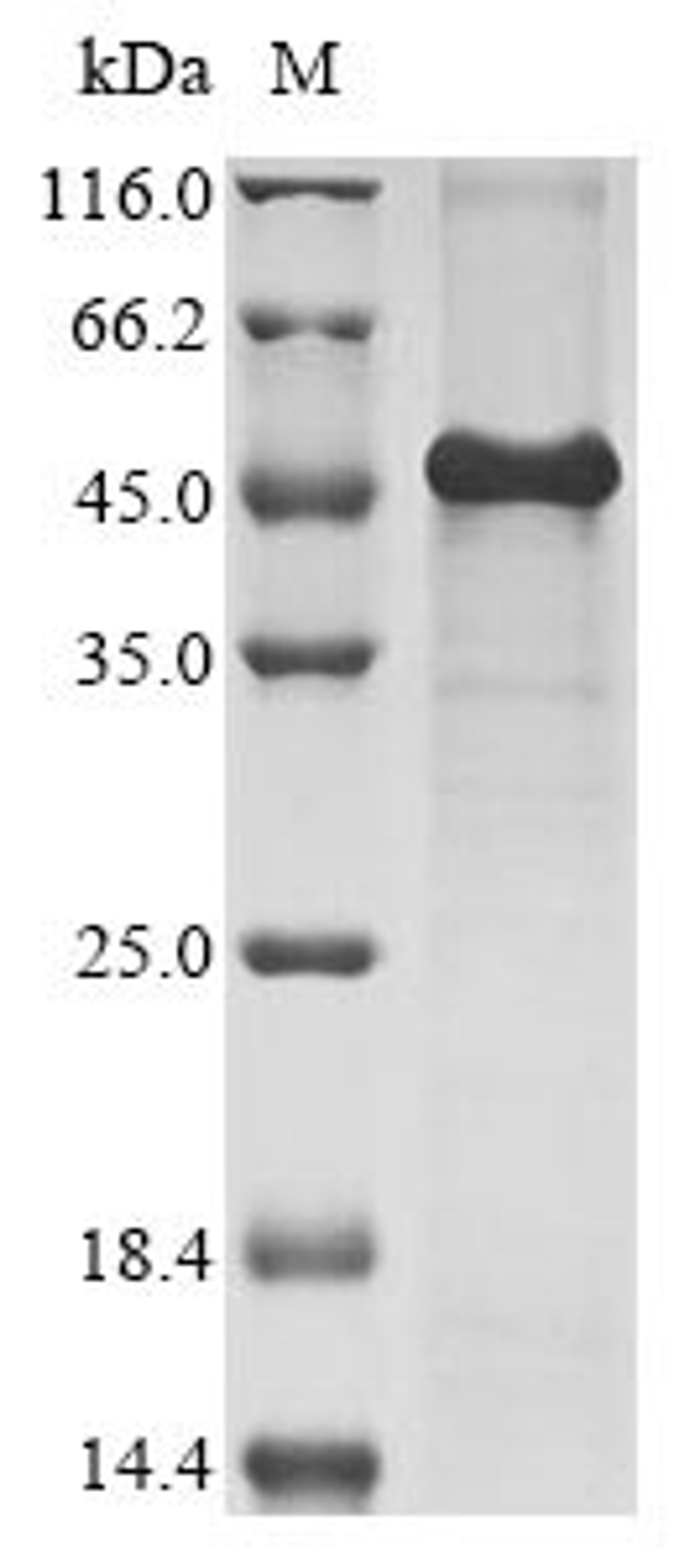 (Tris-Glycine gel) Discontinuous SDS-PAGE (reduced) with 5% enrichment gel and 15% separation gel.