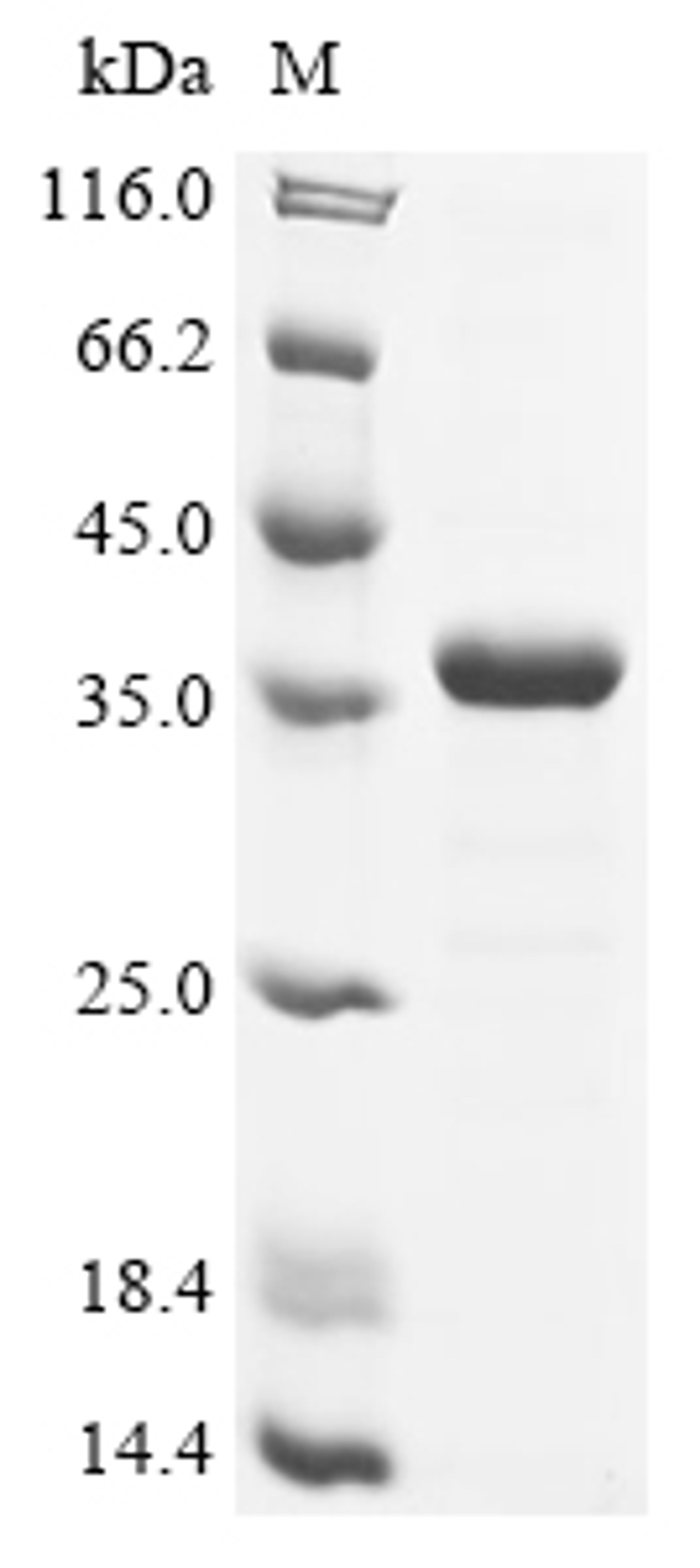 (Tris-Glycine gel) Discontinuous SDS-PAGE (reduced) with 5% enrichment gel and 15% separation gel.