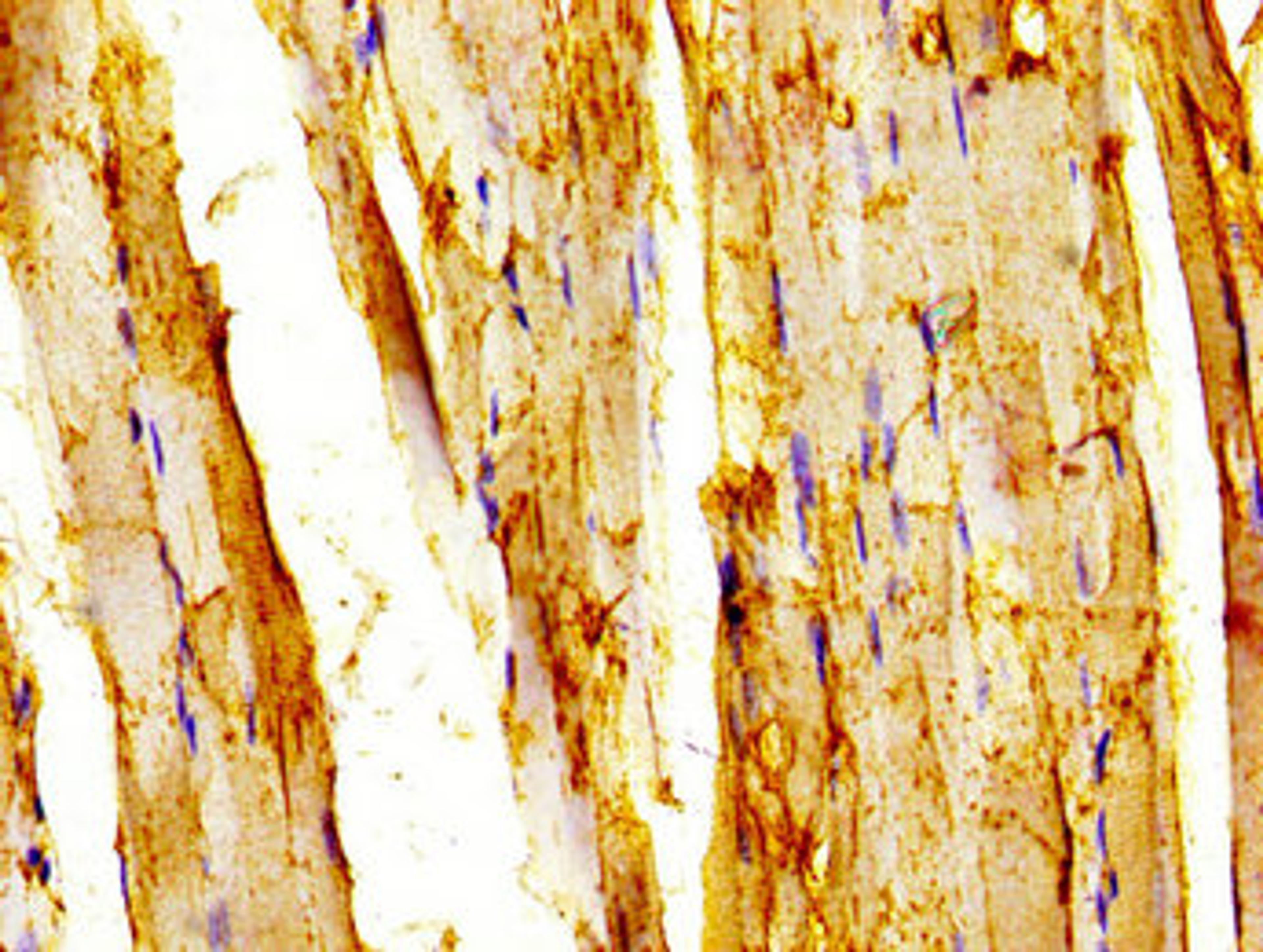 IHC image of CSB-PA757671LA01HU diluted at 1:200 and staining in paraffin-embedded human skeletal muscle tissue performed on a Leica BondTM system. After dewaxing and hydration, antigen retrieval was mediated by high pressure in a citrate buffer (pH 6.0). Section was blocked with 10% normal goat serum 30min at RT. Then primary antibody (1% BSA) was incubated at 4&deg;C overnight. The primary is detected by a biotinylated secondary antibody and visualized using an HRP conjugated SP system.